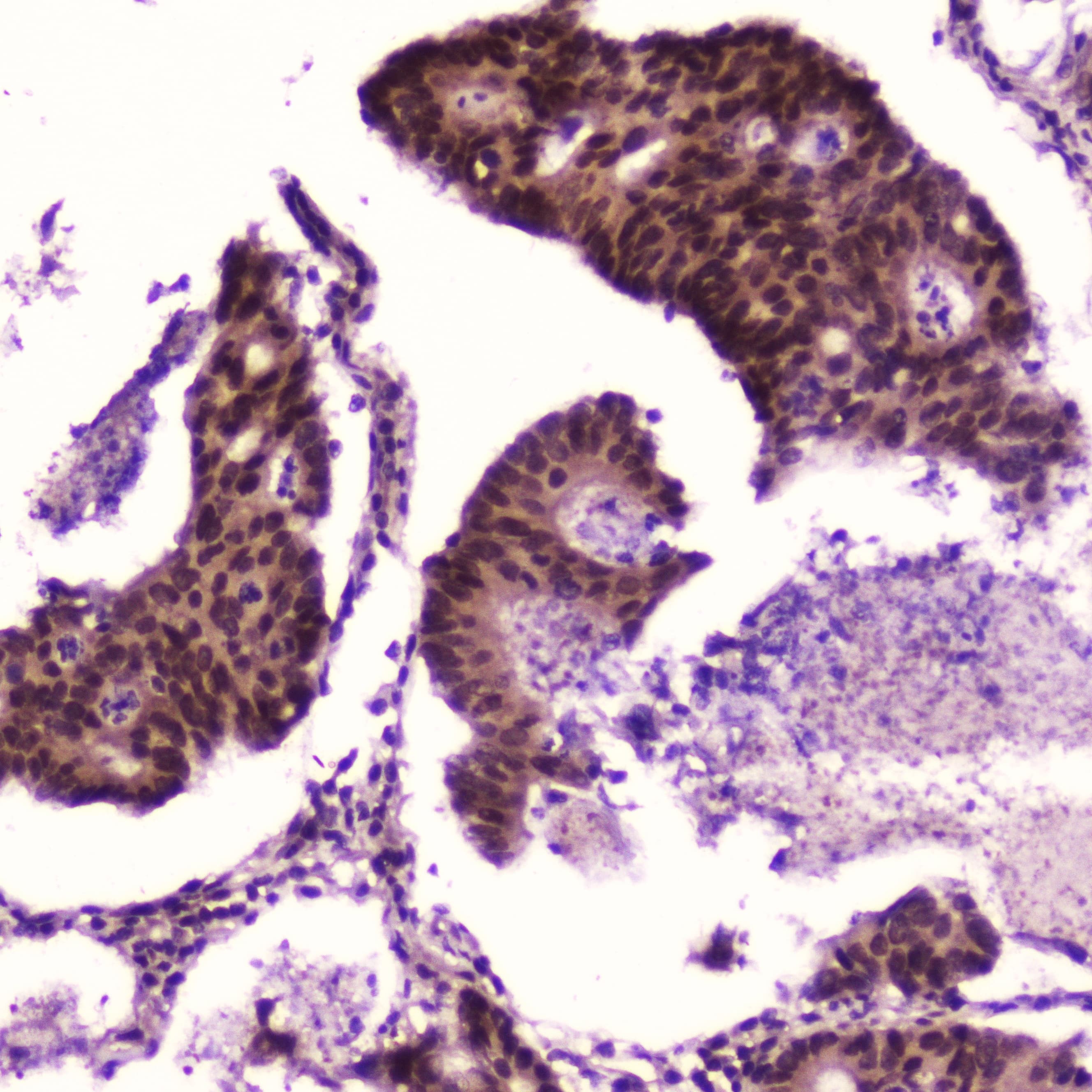 Polyclonal Rabbit anti-Human RELA / NFKB p65 Antibody (IHC, WB)