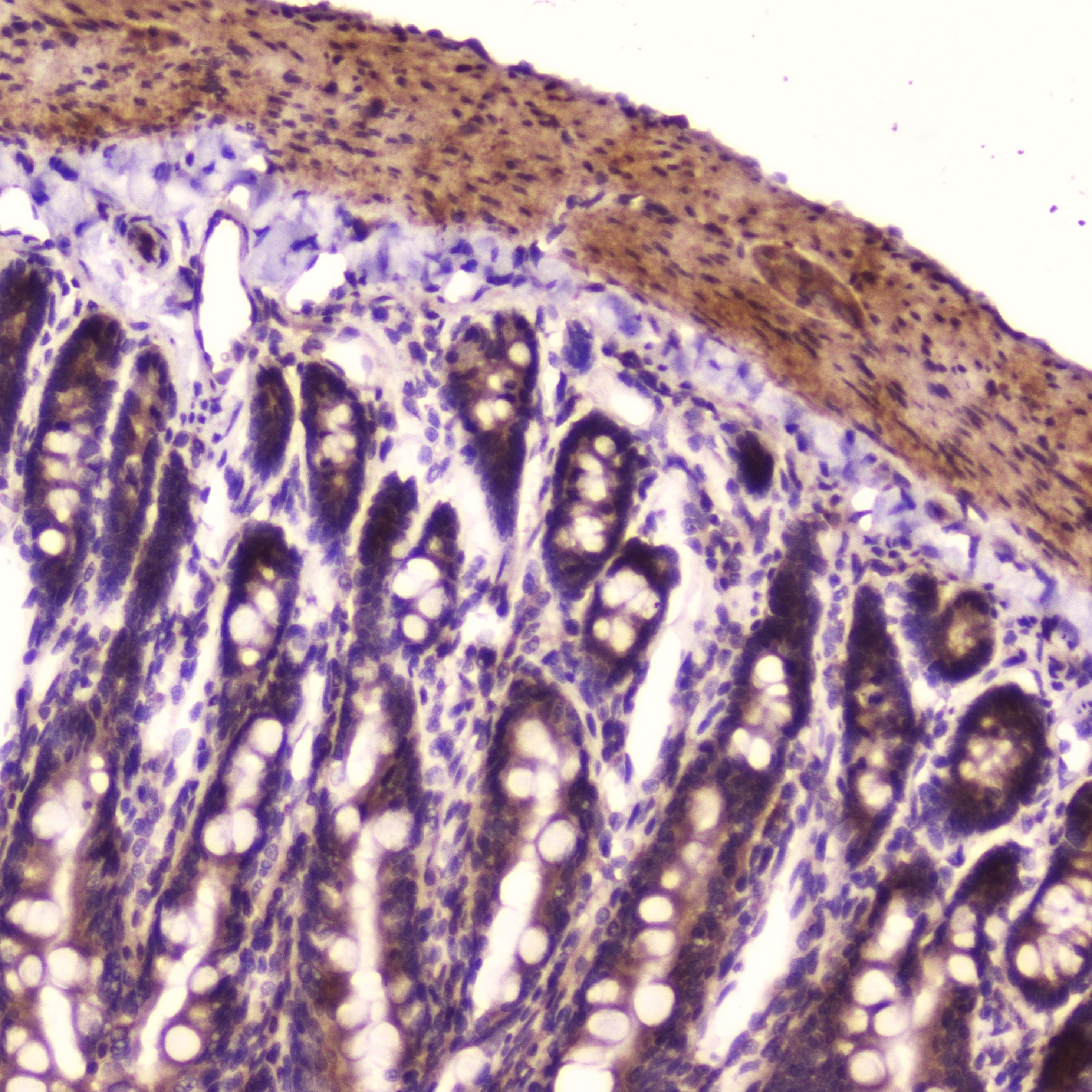 Polyclonal Rabbit anti-Human RELA / NFKB p65 Antibody (IHC, WB)