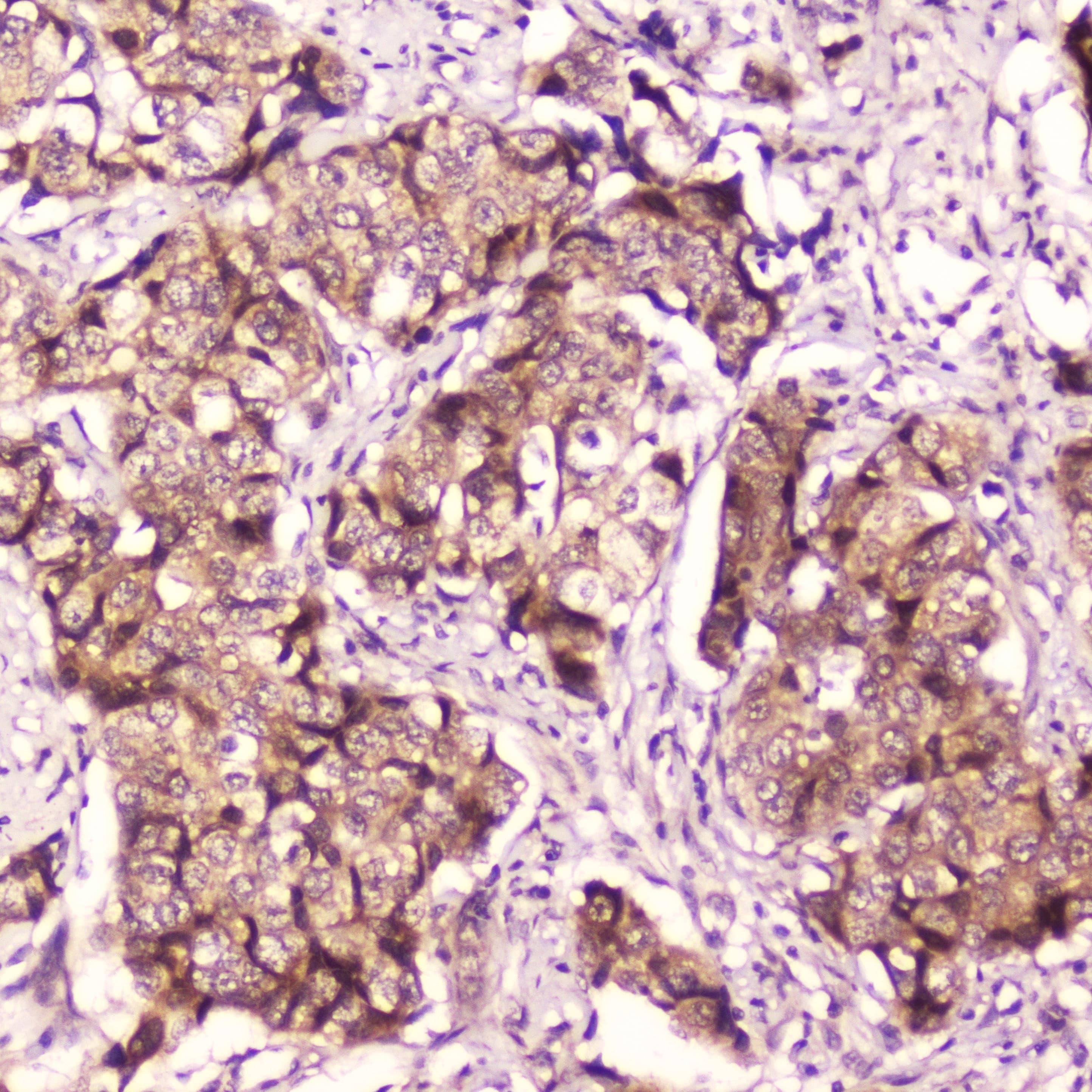 Polyclonal Rabbit anti-Human RELA / NFKB p65 Antibody (IHC, WB)