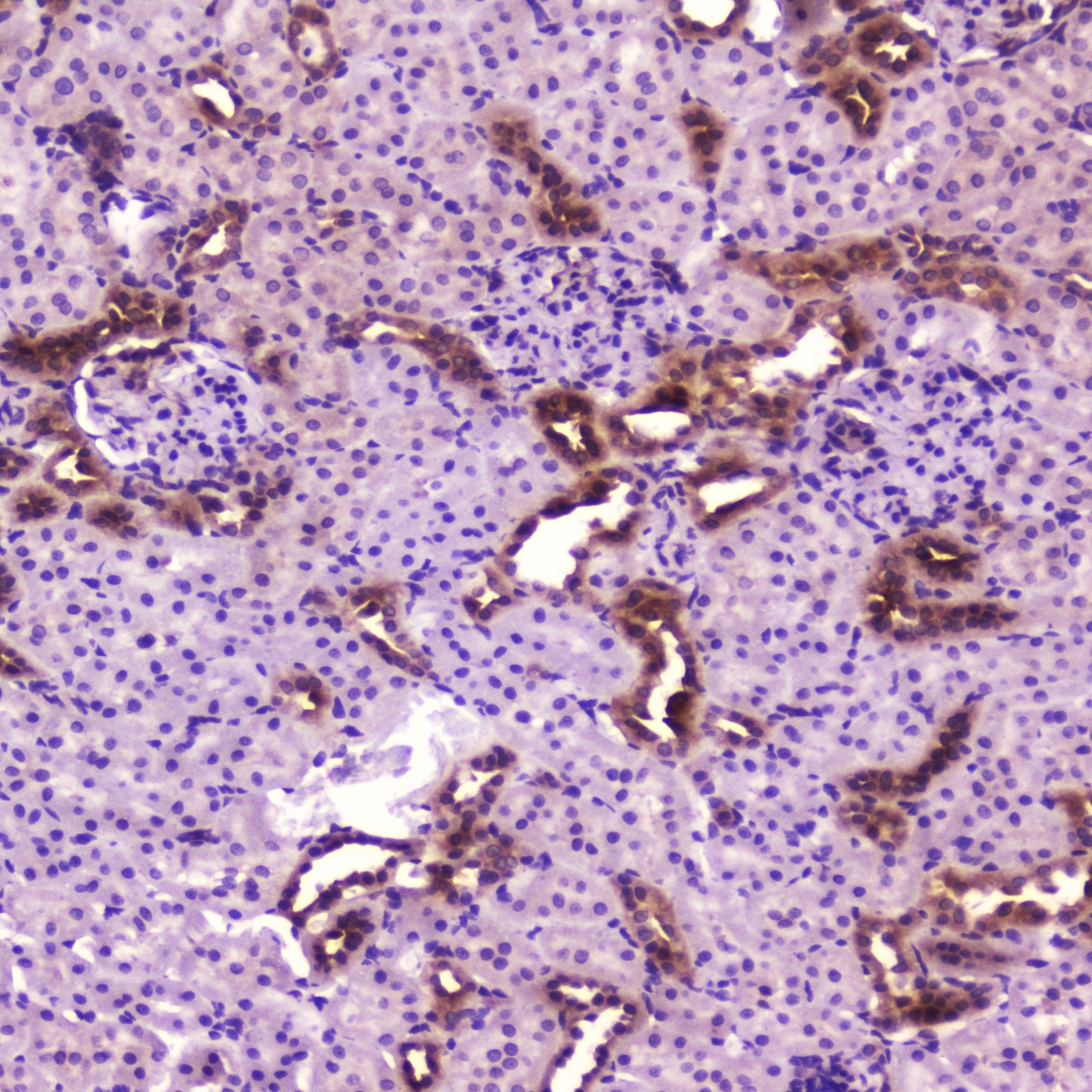 Polyclonal Rabbit anti-Human RELA / NFKB p65 Antibody (IHC, WB)