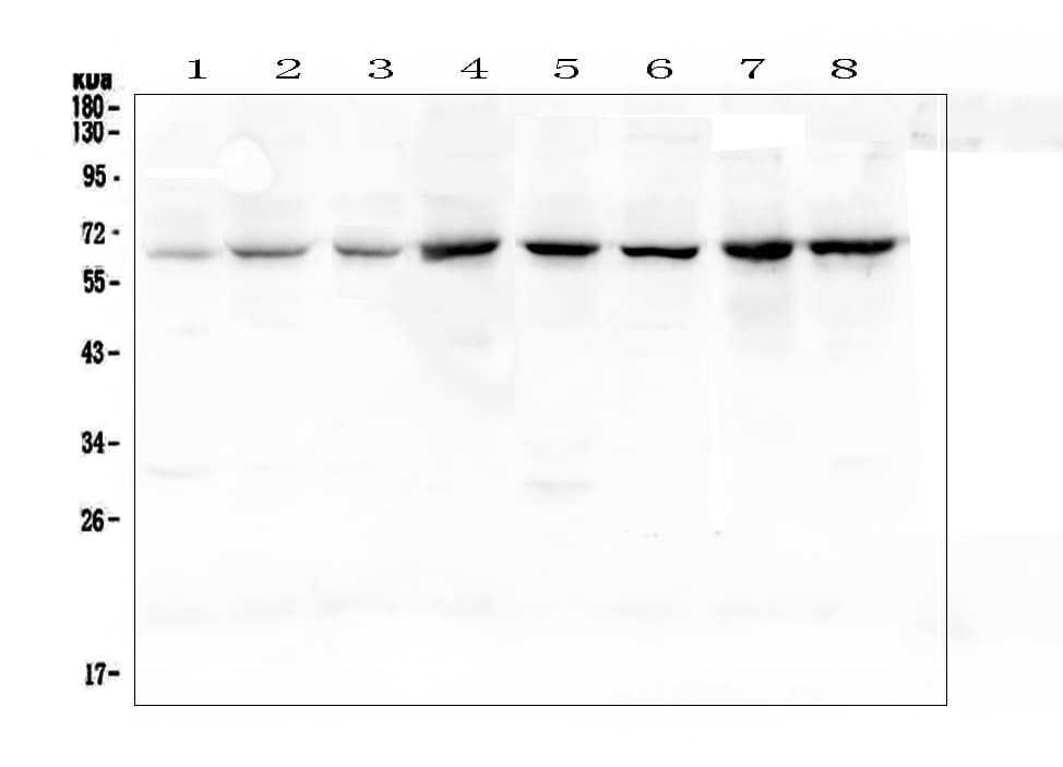Polyclonal Rabbit anti-Human RELA / NFKB p65 Antibody (IHC, WB)
