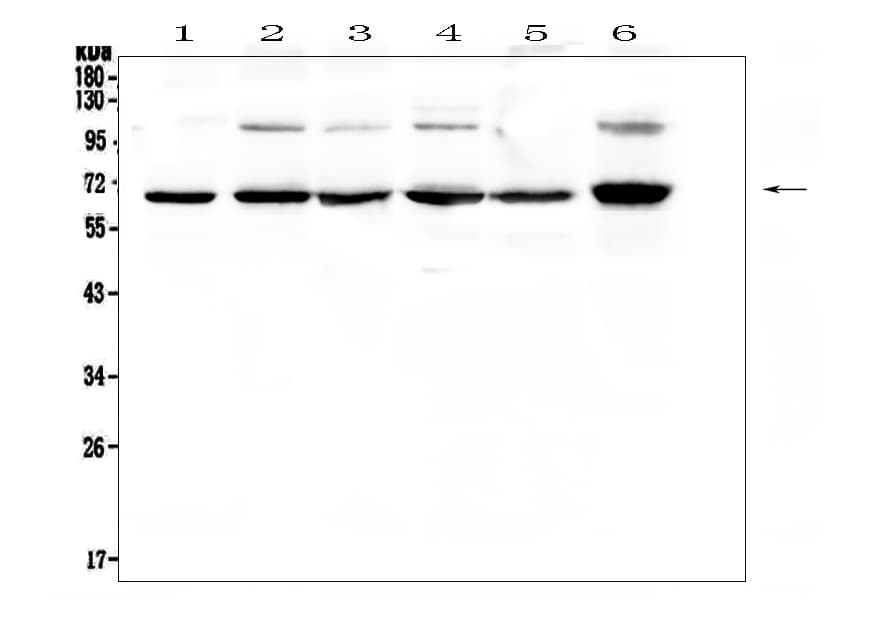 Polyclonal Rabbit anti-Human RELA / NFKB p65 Antibody (IHC, WB)