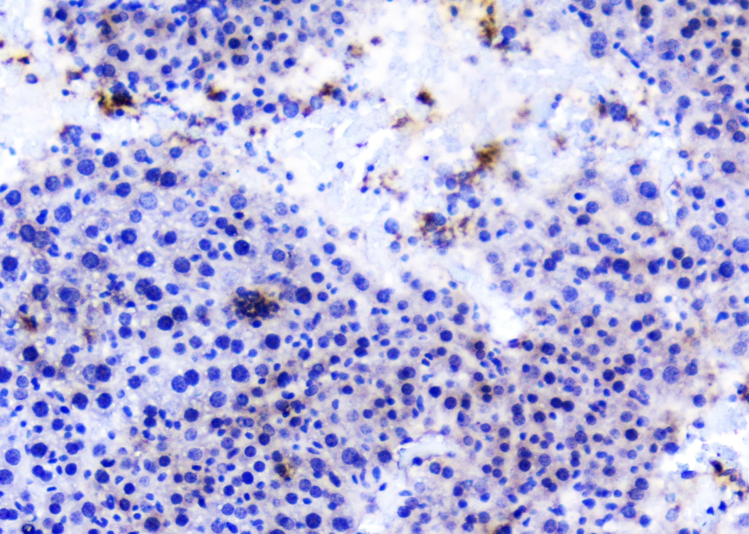 Polyclonal Rabbit anti-Human TANK Antibody (IHC, WB)
