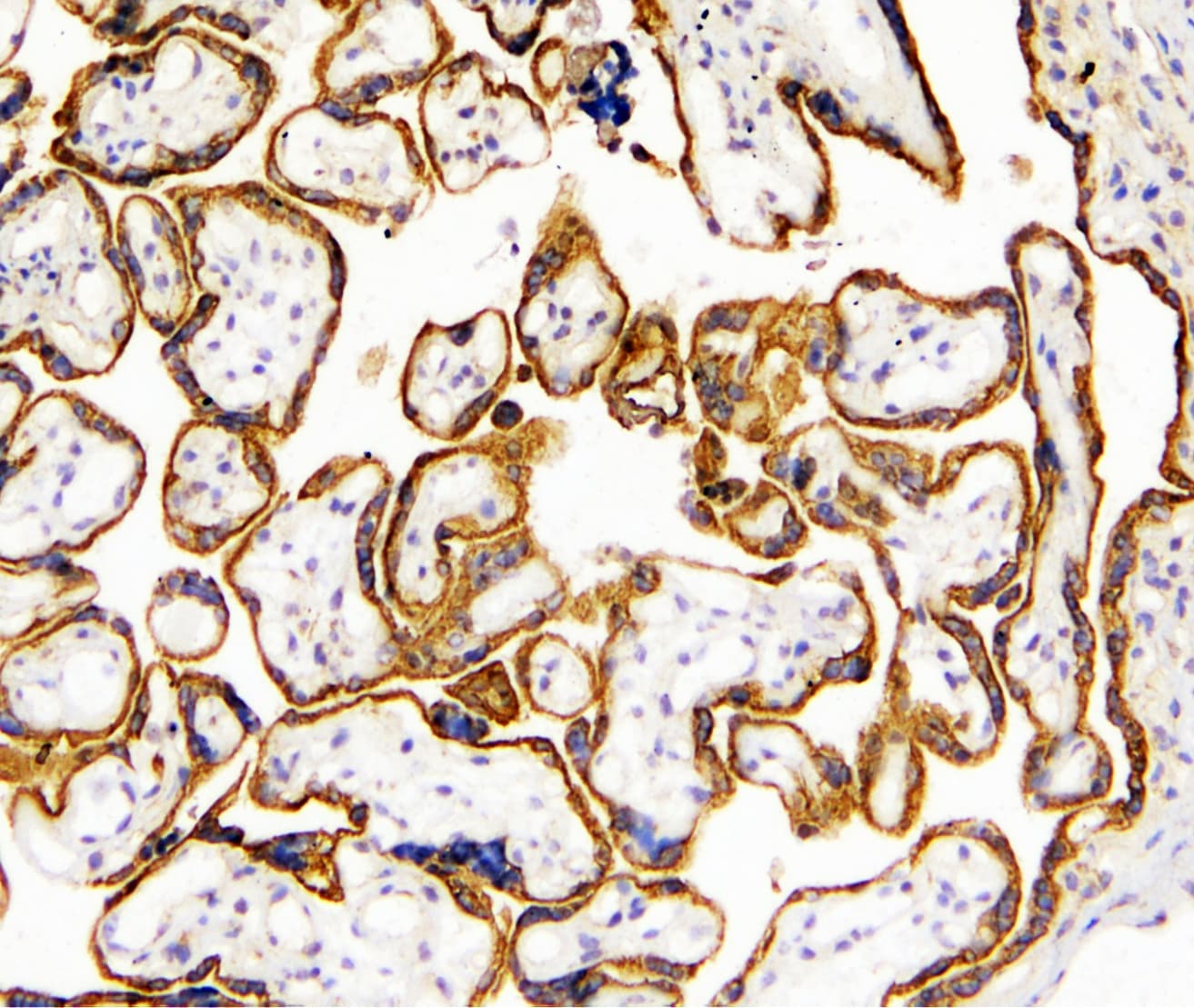 Polyclonal Rabbit anti-Human TANK Antibody (IHC, WB)