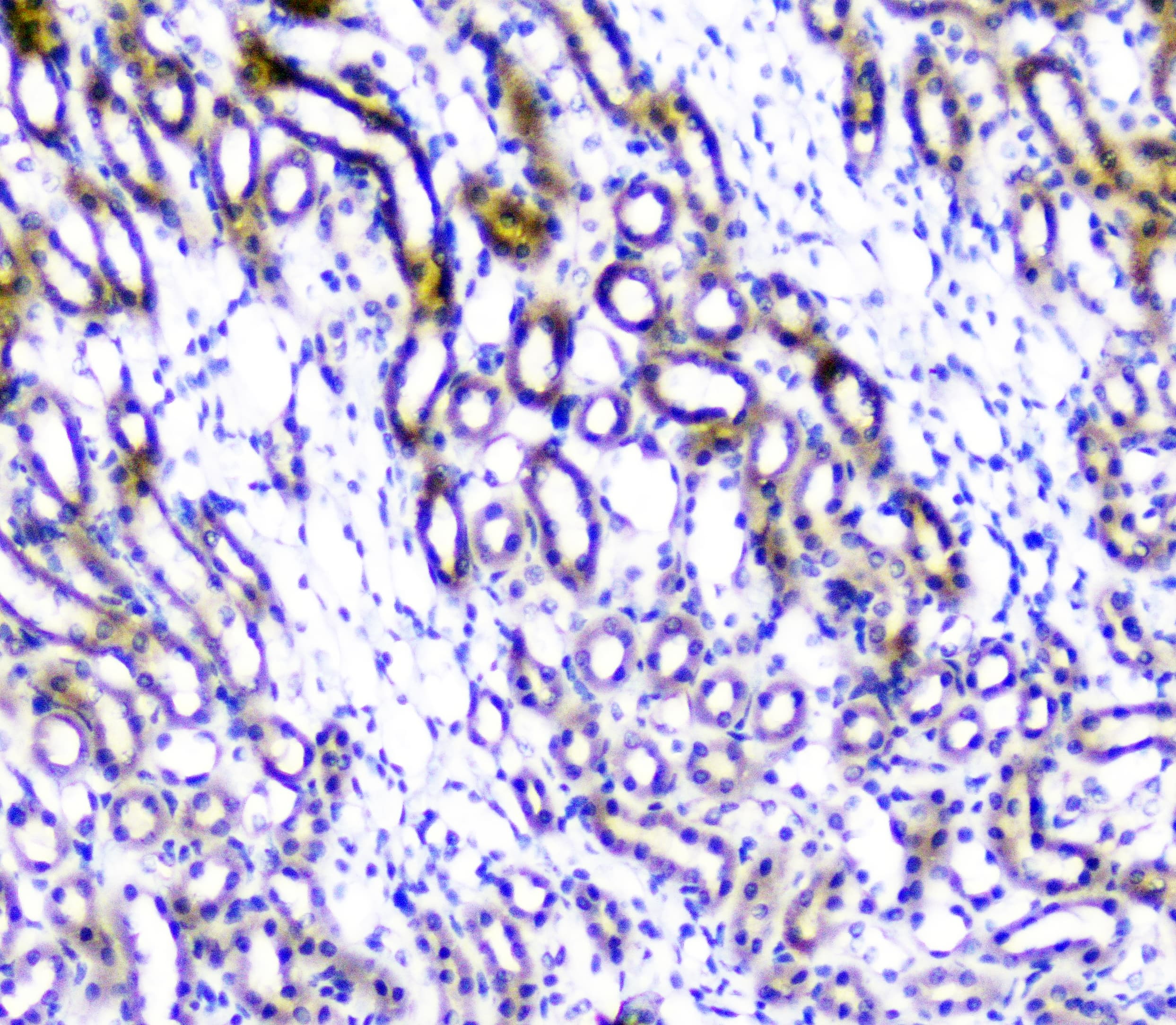 Polyclonal Rabbit anti-Human TANK Antibody (IHC, WB)