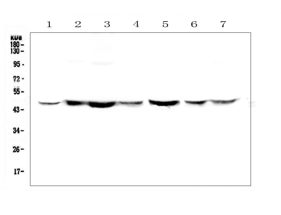 Polyclonal Rabbit anti-Human TANK Antibody (IHC, WB)