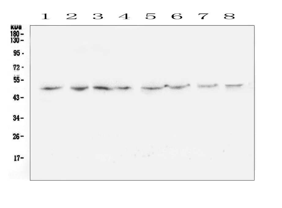 Polyclonal Rabbit anti-Human TANK Antibody (IHC, WB)