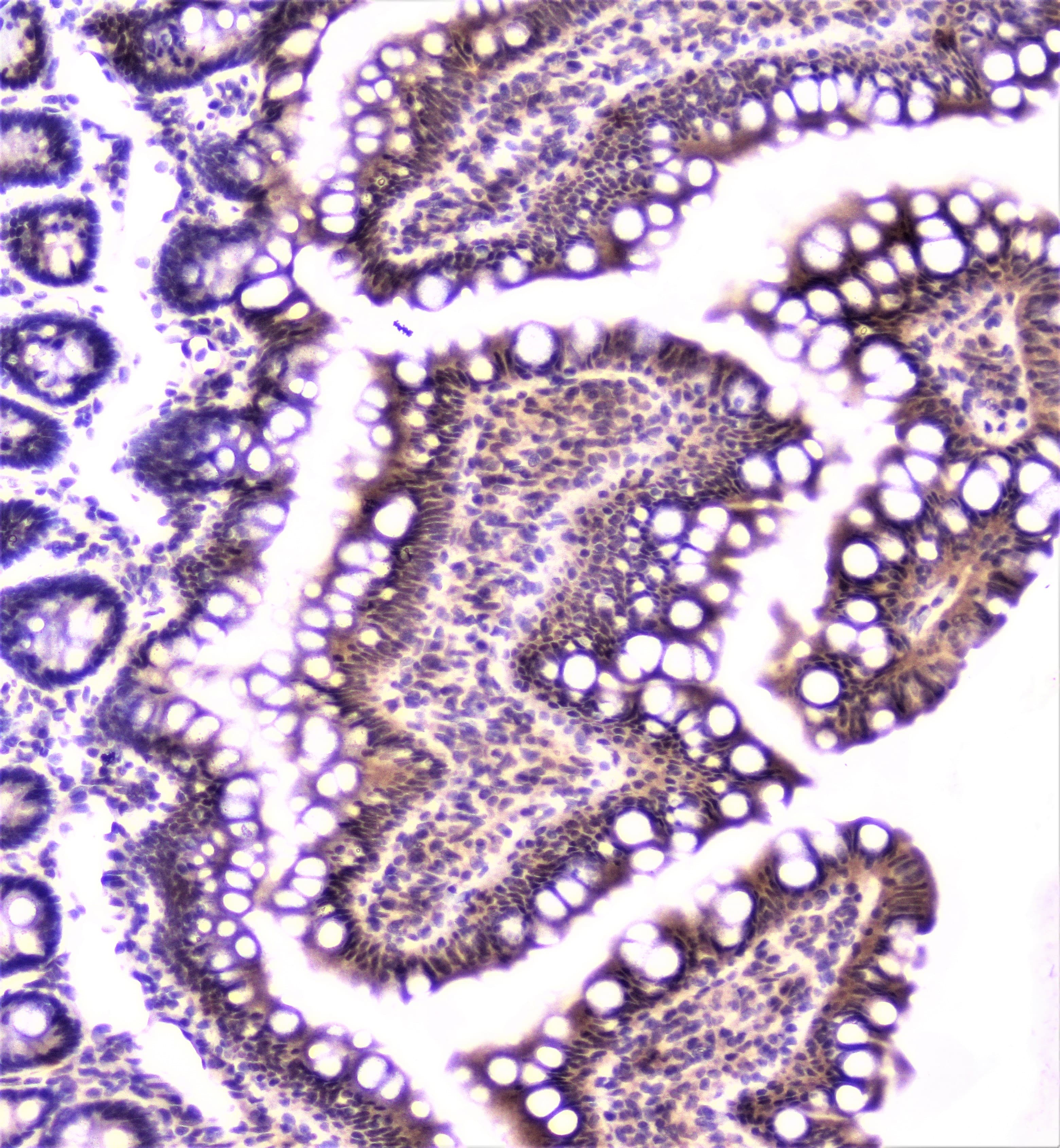 Polyclonal Rabbit anti-Human TANK Antibody (IHC, WB)