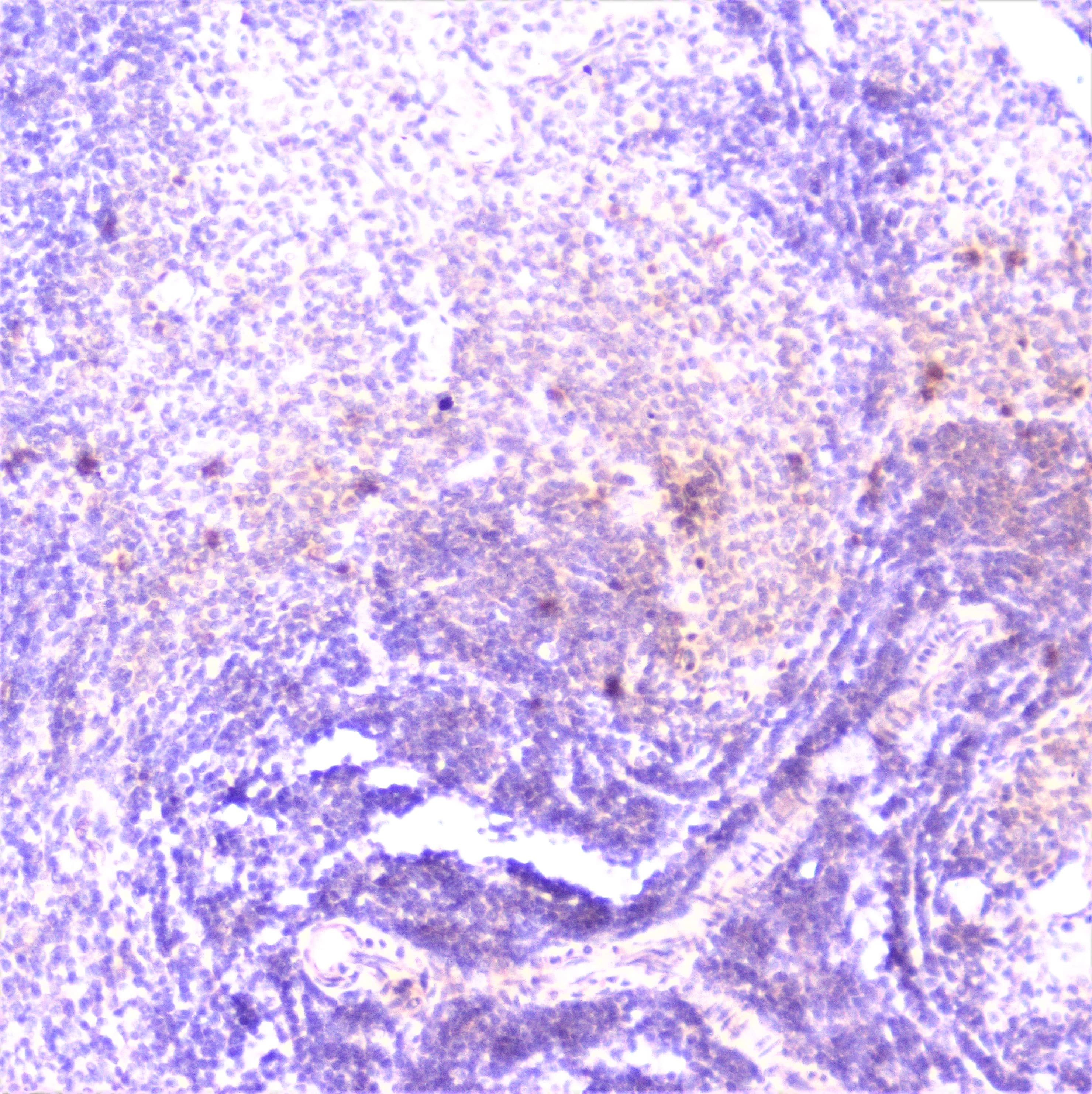 Polyclonal Rabbit anti-Human TANK Antibody (IHC, WB)