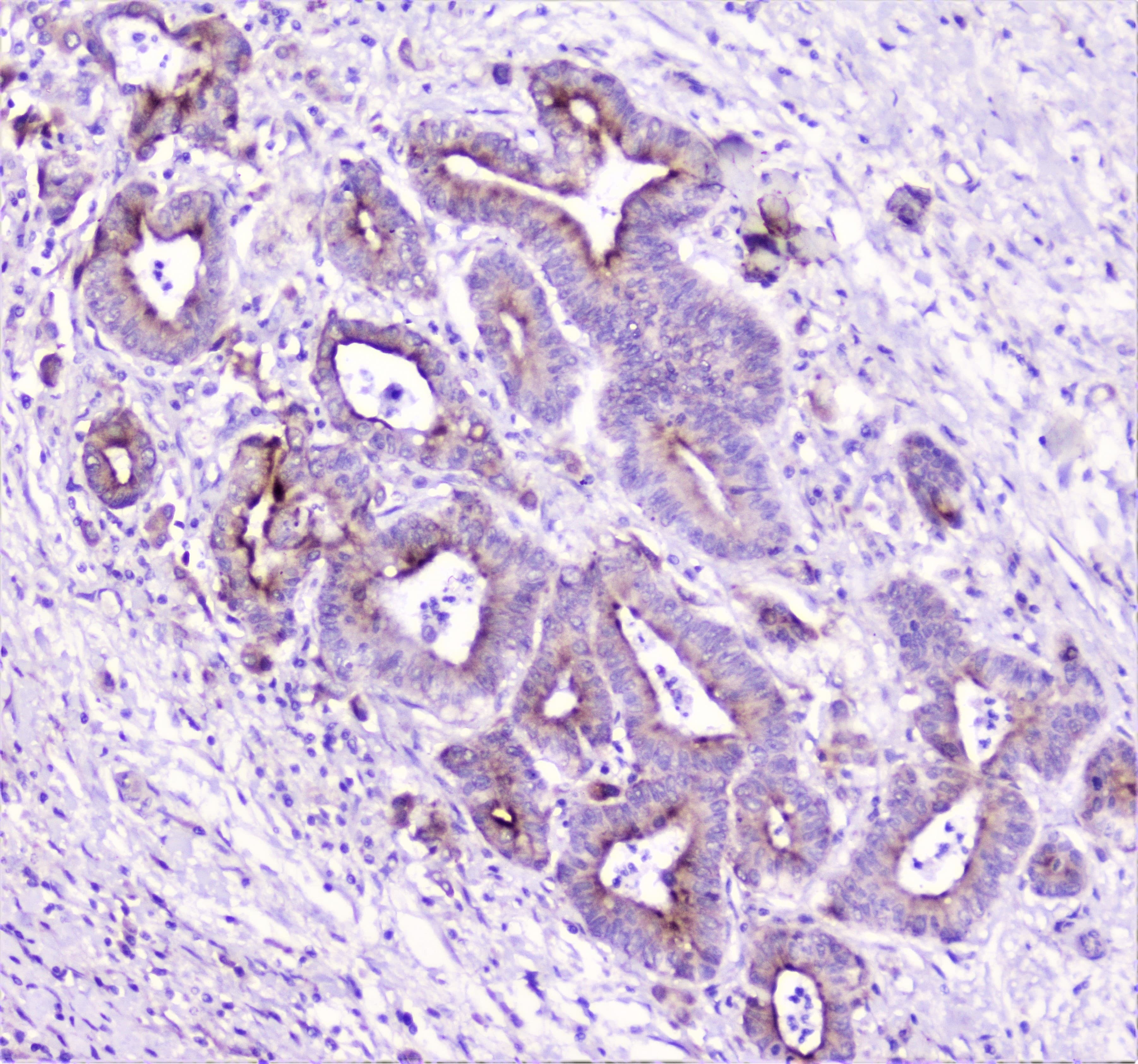 Polyclonal Rabbit anti-Human TANK Antibody (IHC, WB)