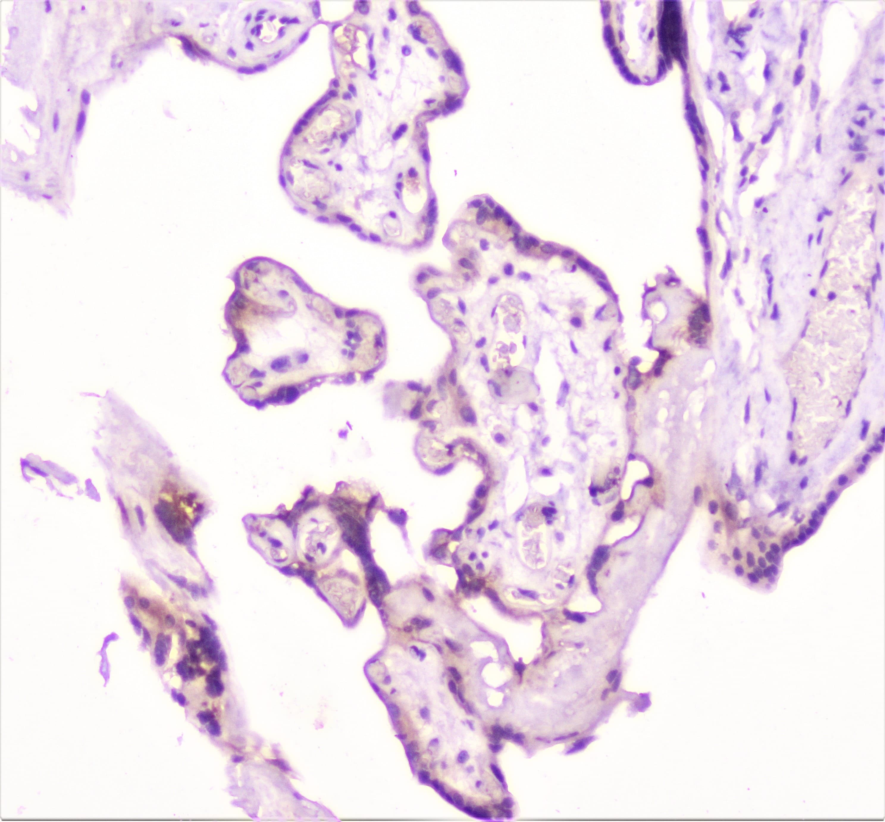 Polyclonal Rabbit anti-Human TANK Antibody (IHC, WB)