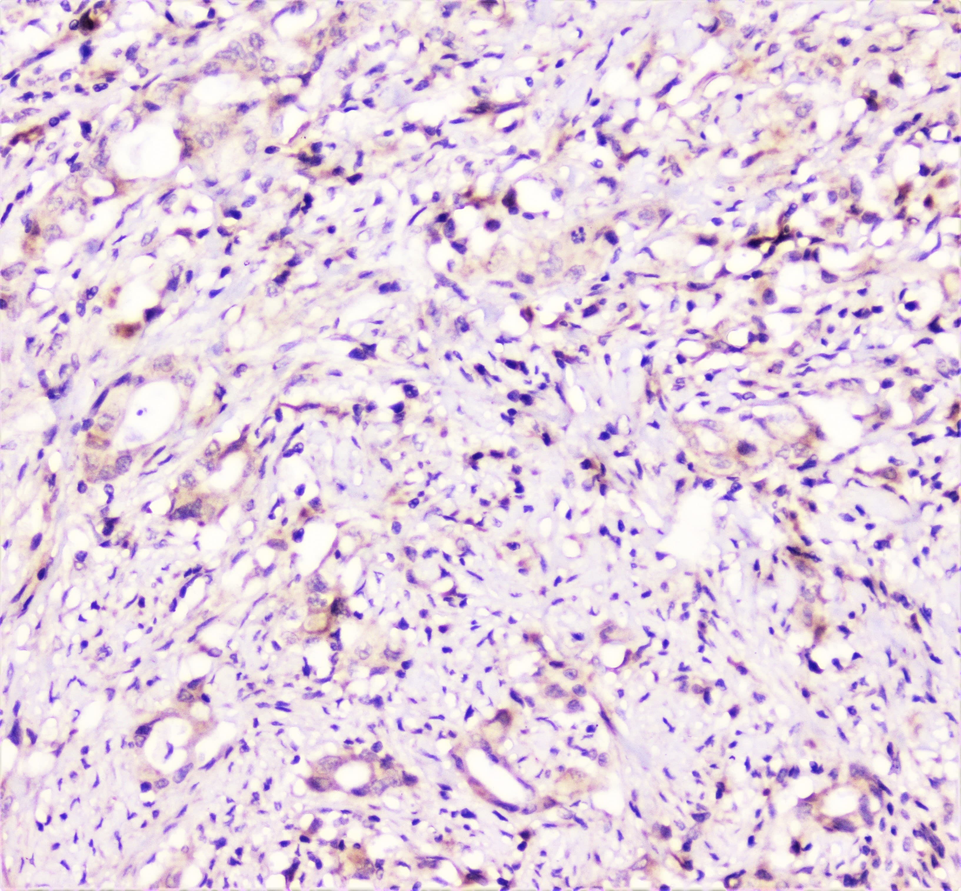 Polyclonal Rabbit anti-Human TANK Antibody (IHC, WB)