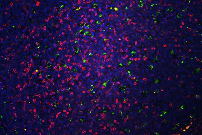 Polyclonal Rabbit anti-Human CD5 Antibody (IHC, WB)