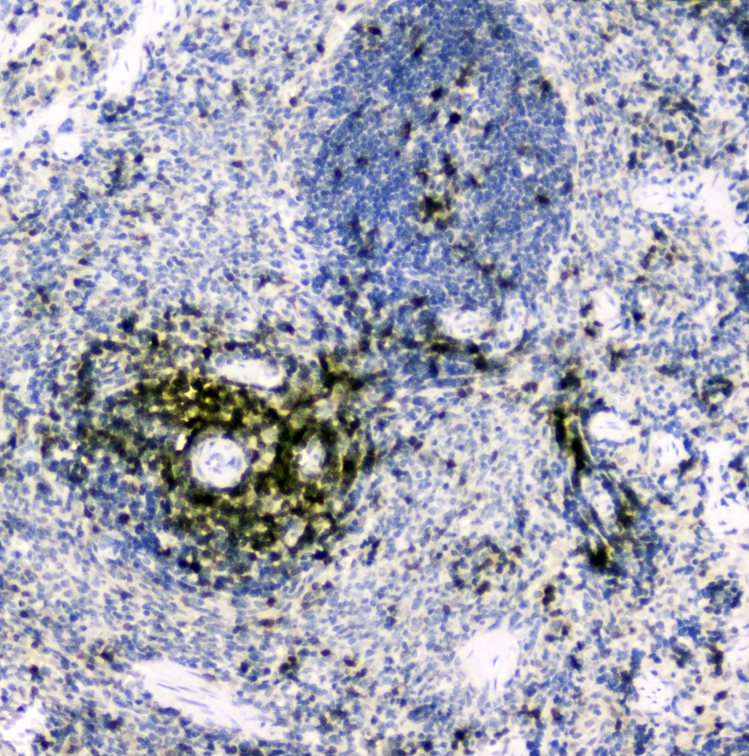 Polyclonal Rabbit anti-Human CD5 Antibody (IHC, WB)