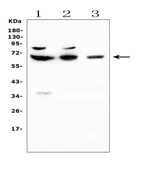 Polyclonal Rabbit anti-Human CD5 Antibody (IHC, WB)