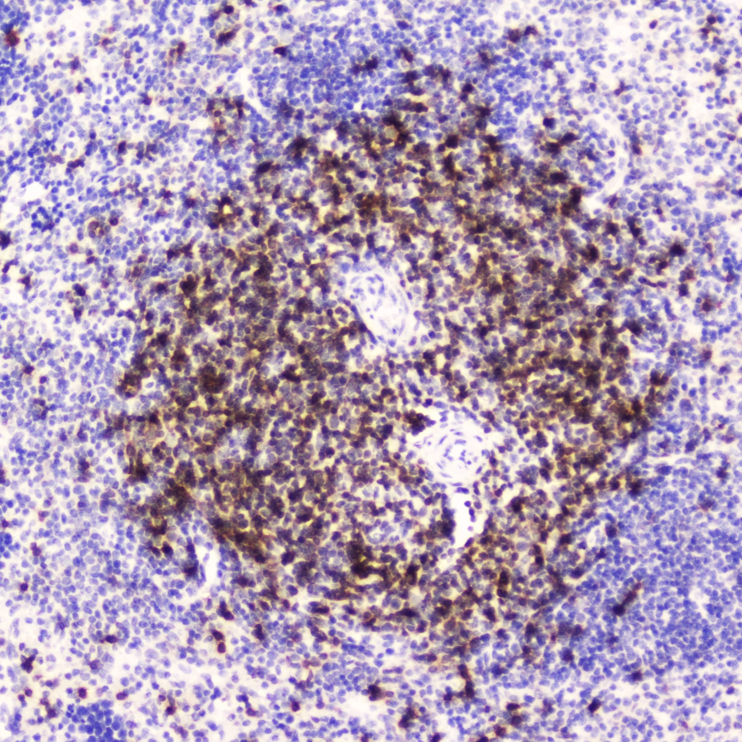 Polyclonal Rabbit anti-Human CD5 Antibody (IHC, WB)