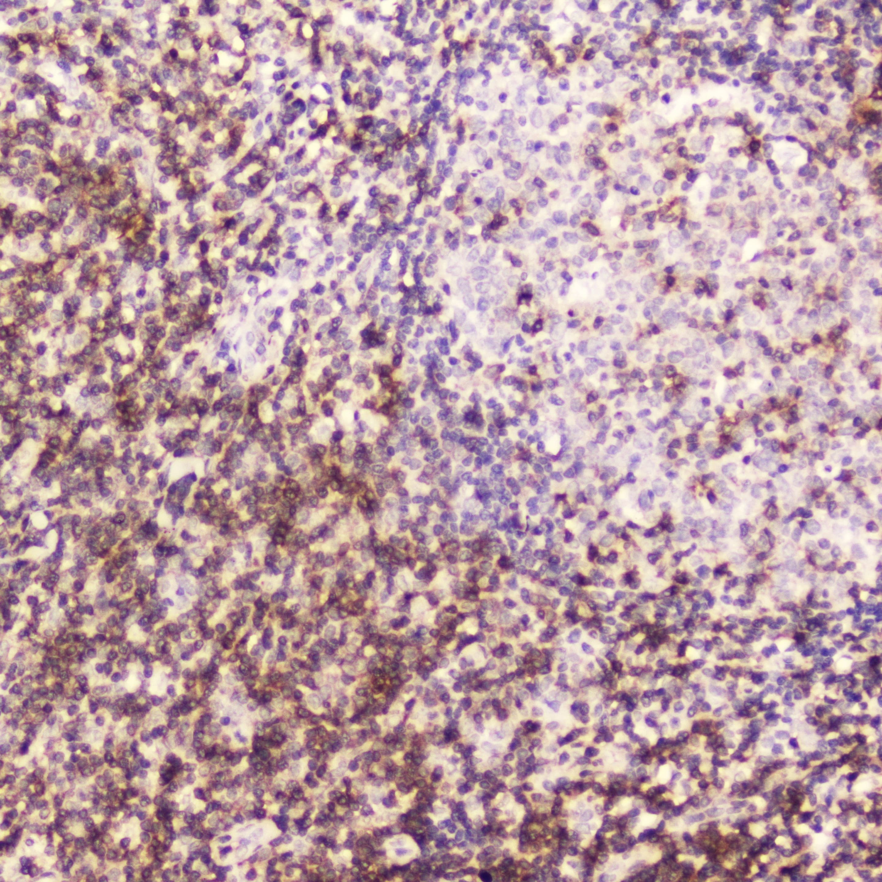 Polyclonal Rabbit anti-Human CD5 Antibody (IHC, WB)