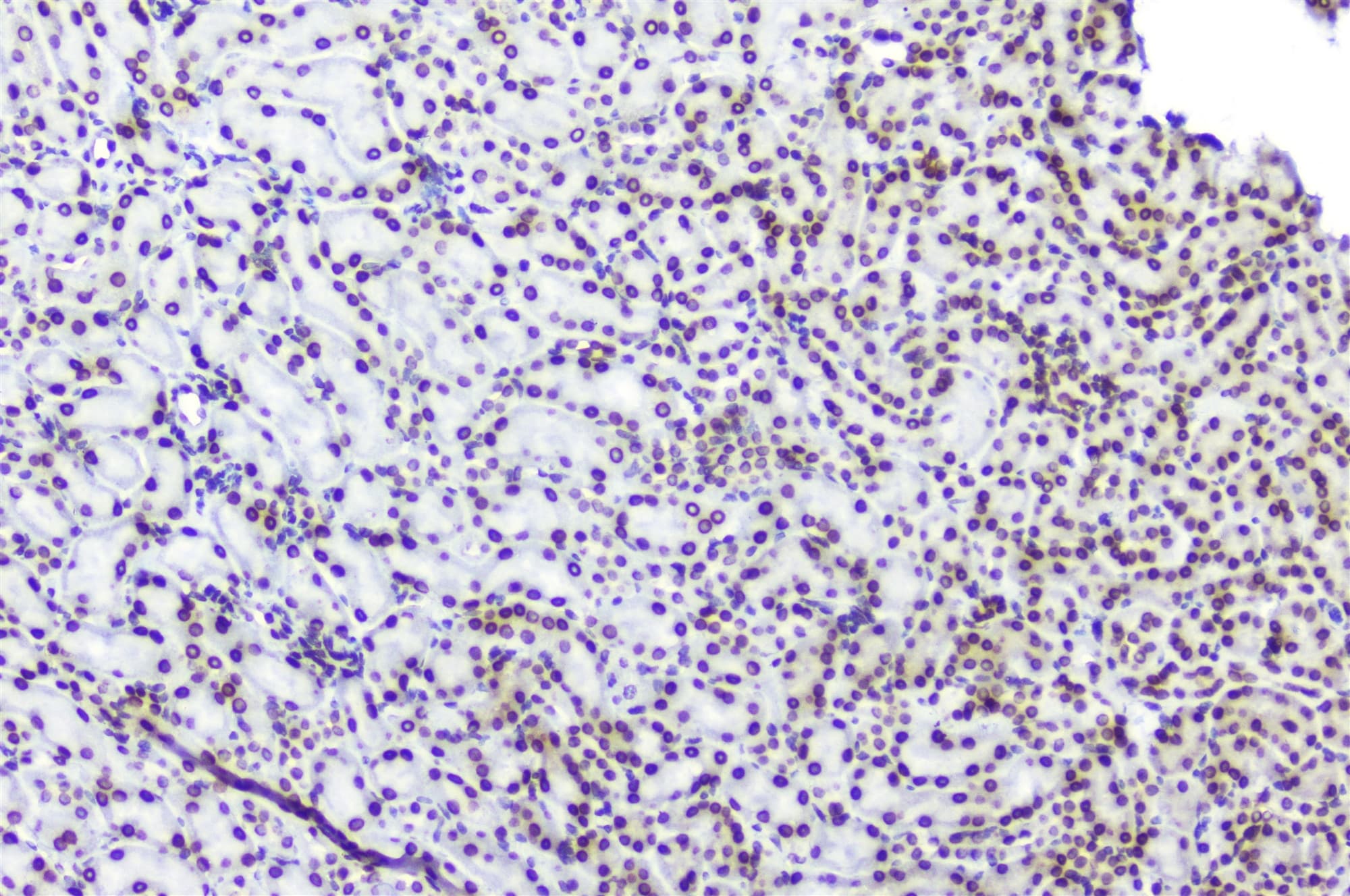 TPR Antibody