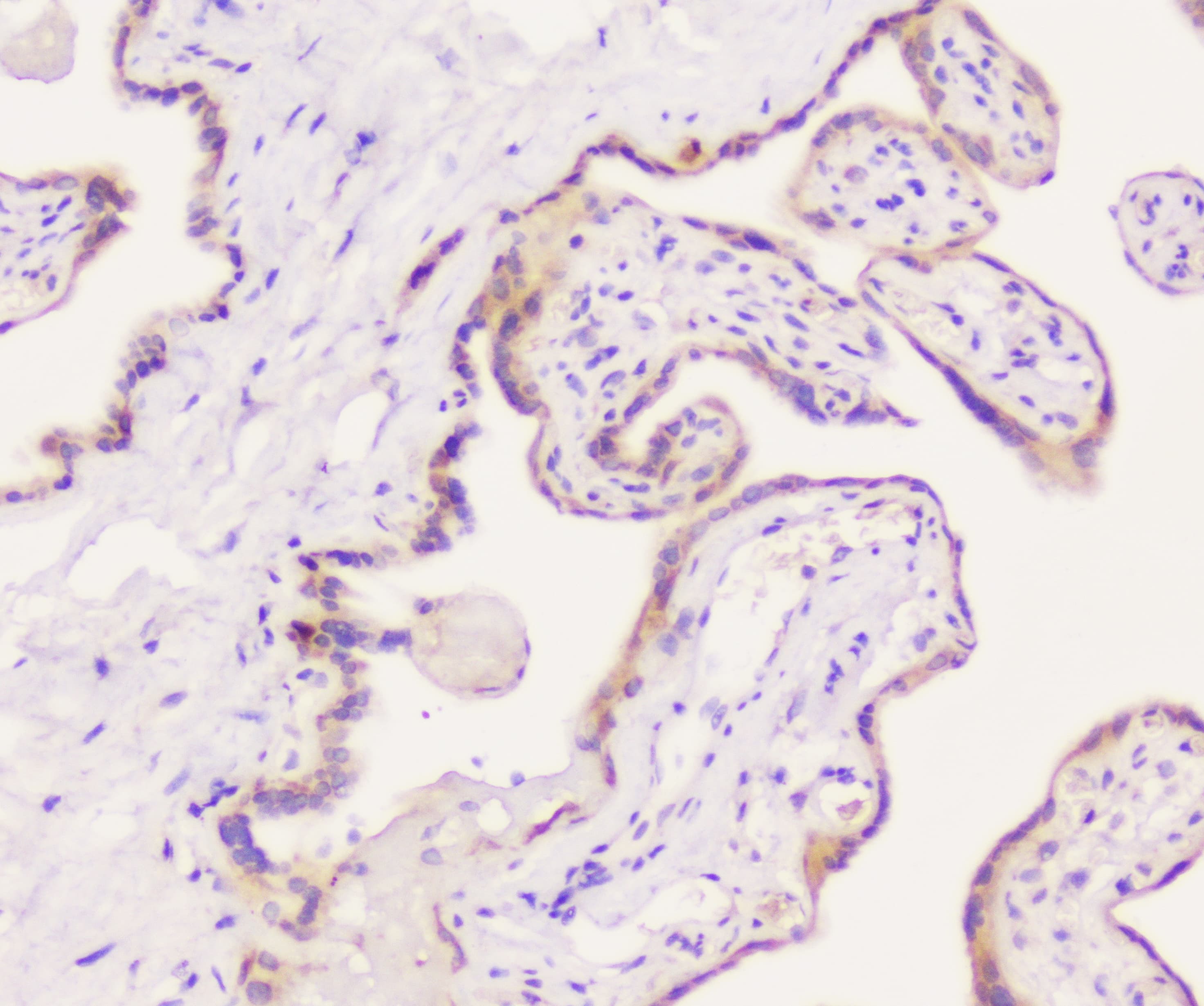 Polyclonal Rabbit anti-Human EML4 Antibody (IHC, WB)
