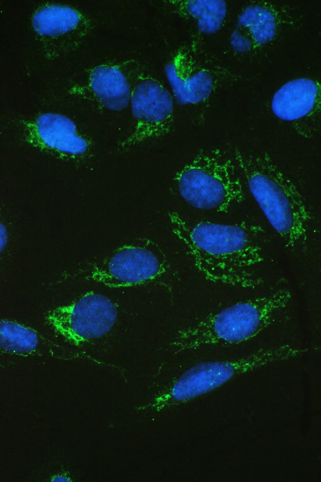SDHB Antibody