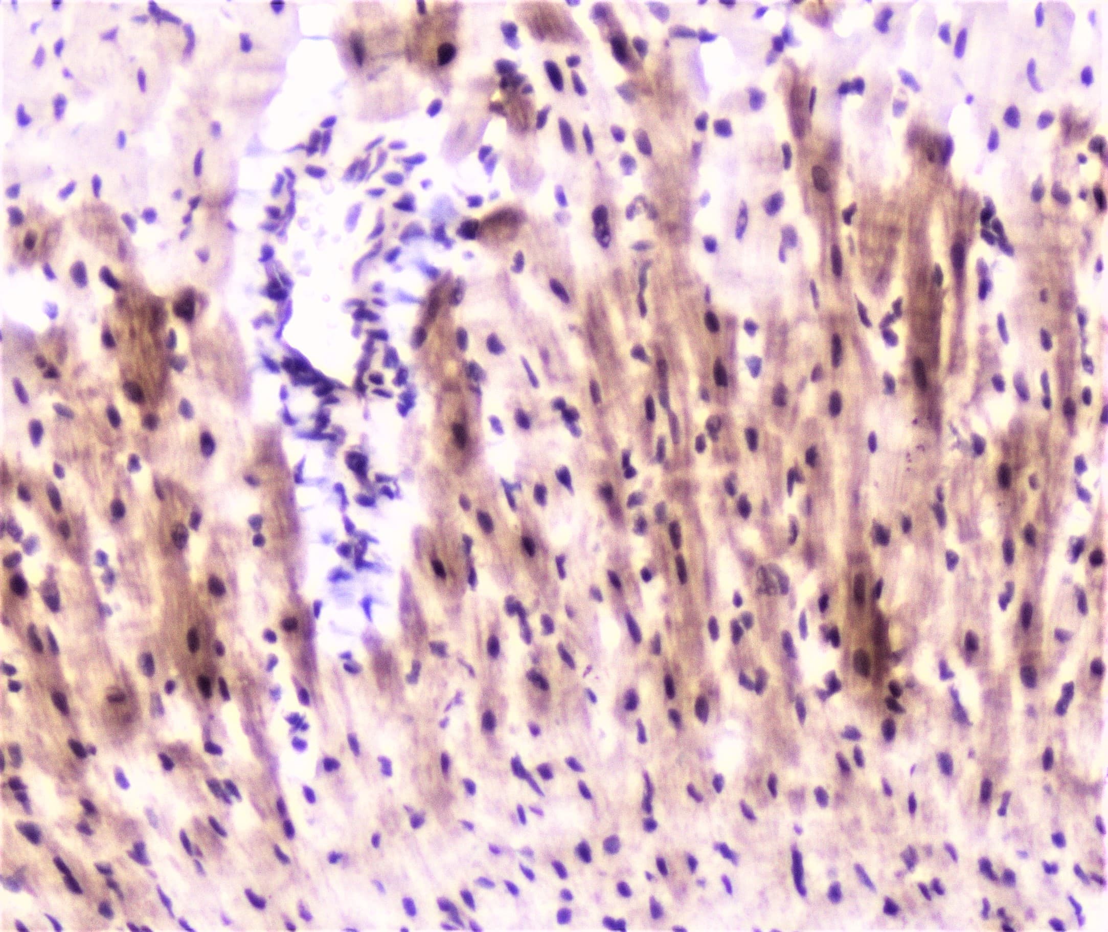 Polyclonal Rabbit anti-Human MEF2C Antibody (IHC, WB)