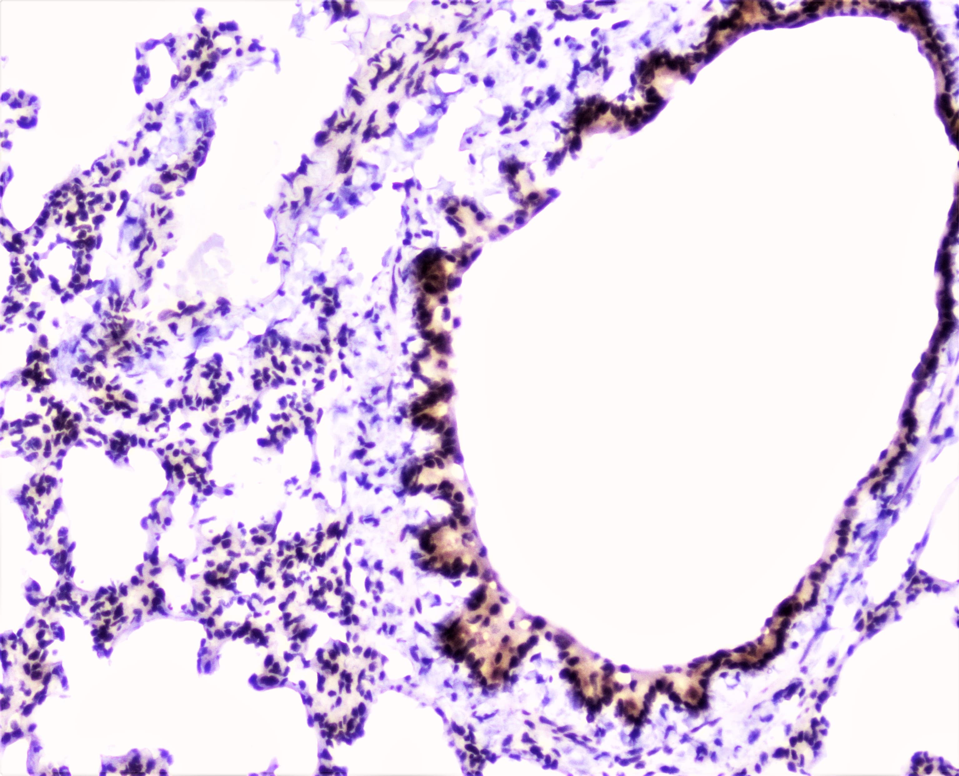 Polyclonal Rabbit anti-Human MEF2C Antibody (IHC, WB)