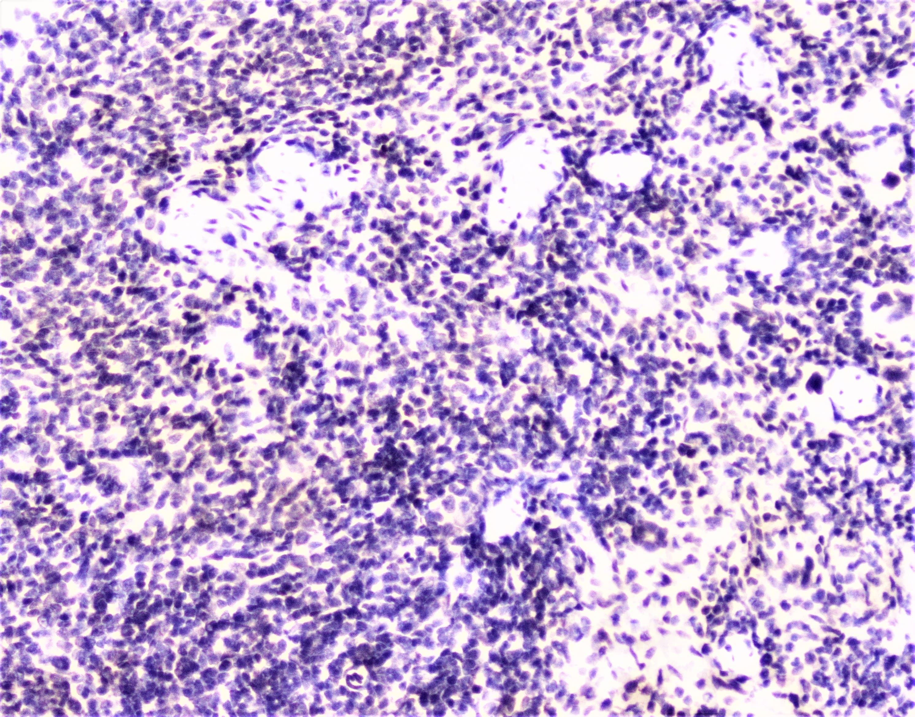 Polyclonal Rabbit anti-Human MEF2C Antibody (IHC, WB)