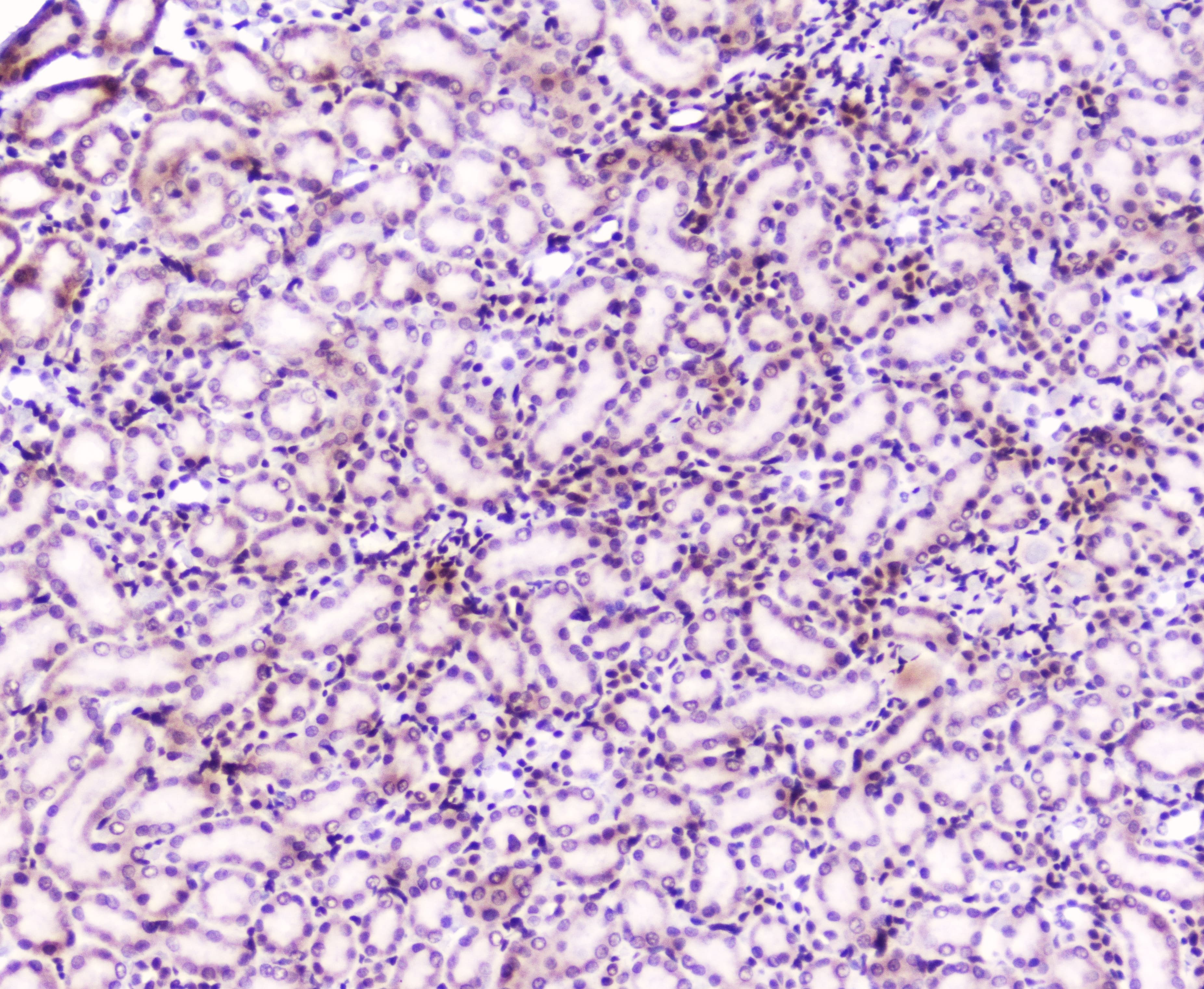 Polyclonal Rabbit anti-Human MEF2C Antibody (IHC, WB)
