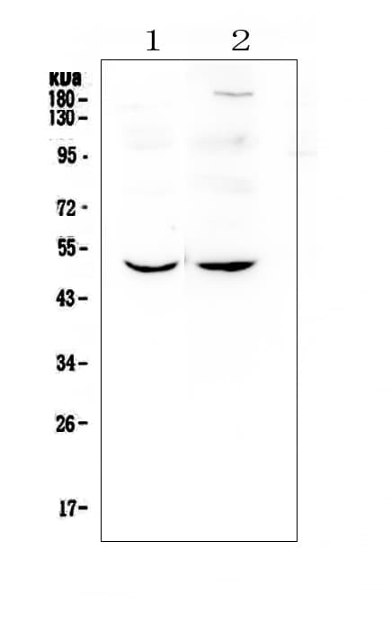 Polyclonal Rabbit anti-Human MEF2C Antibody (IHC, WB)