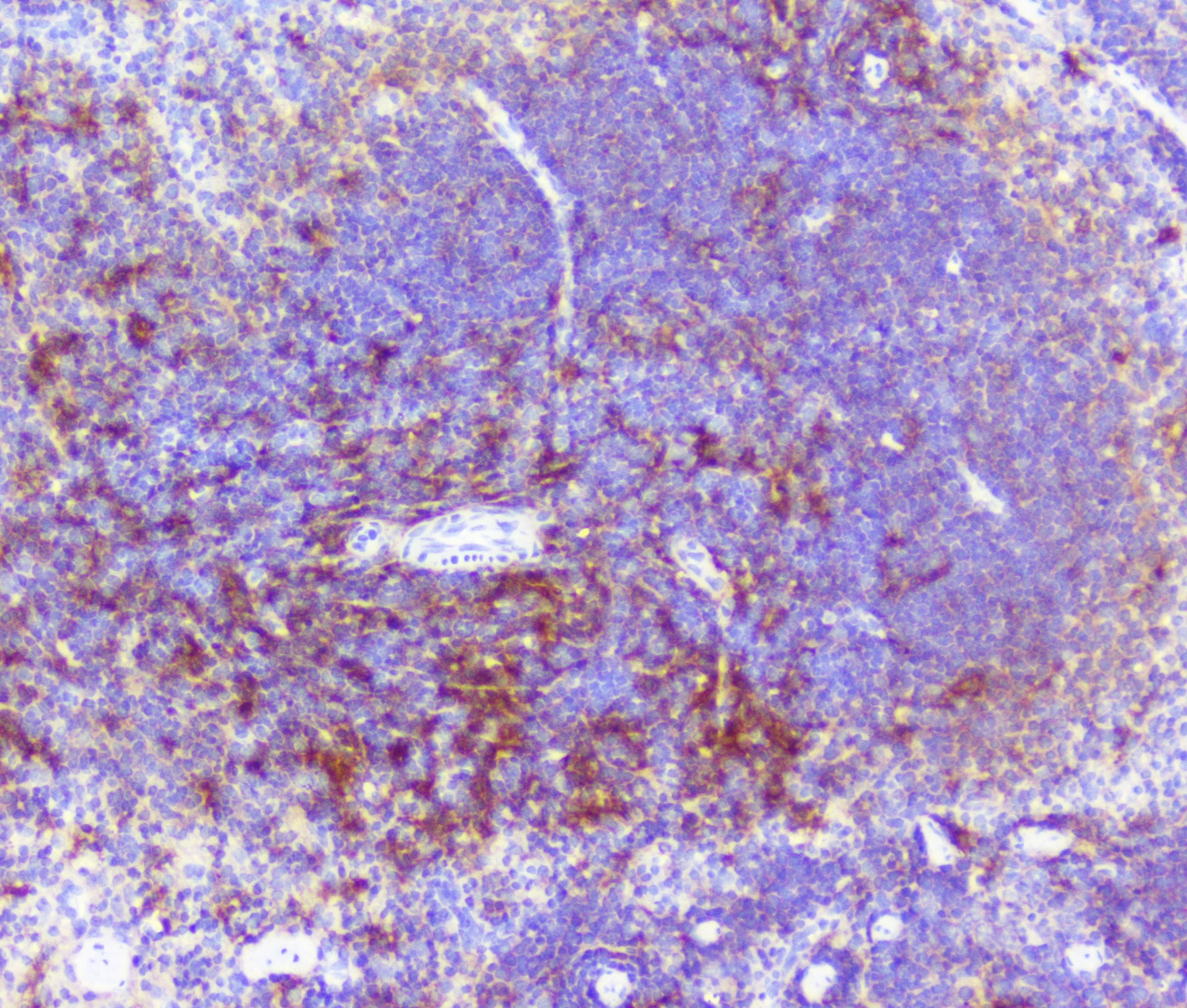 Polyclonal Rabbit anti-Human RP2 Antibody (IHC, WB)