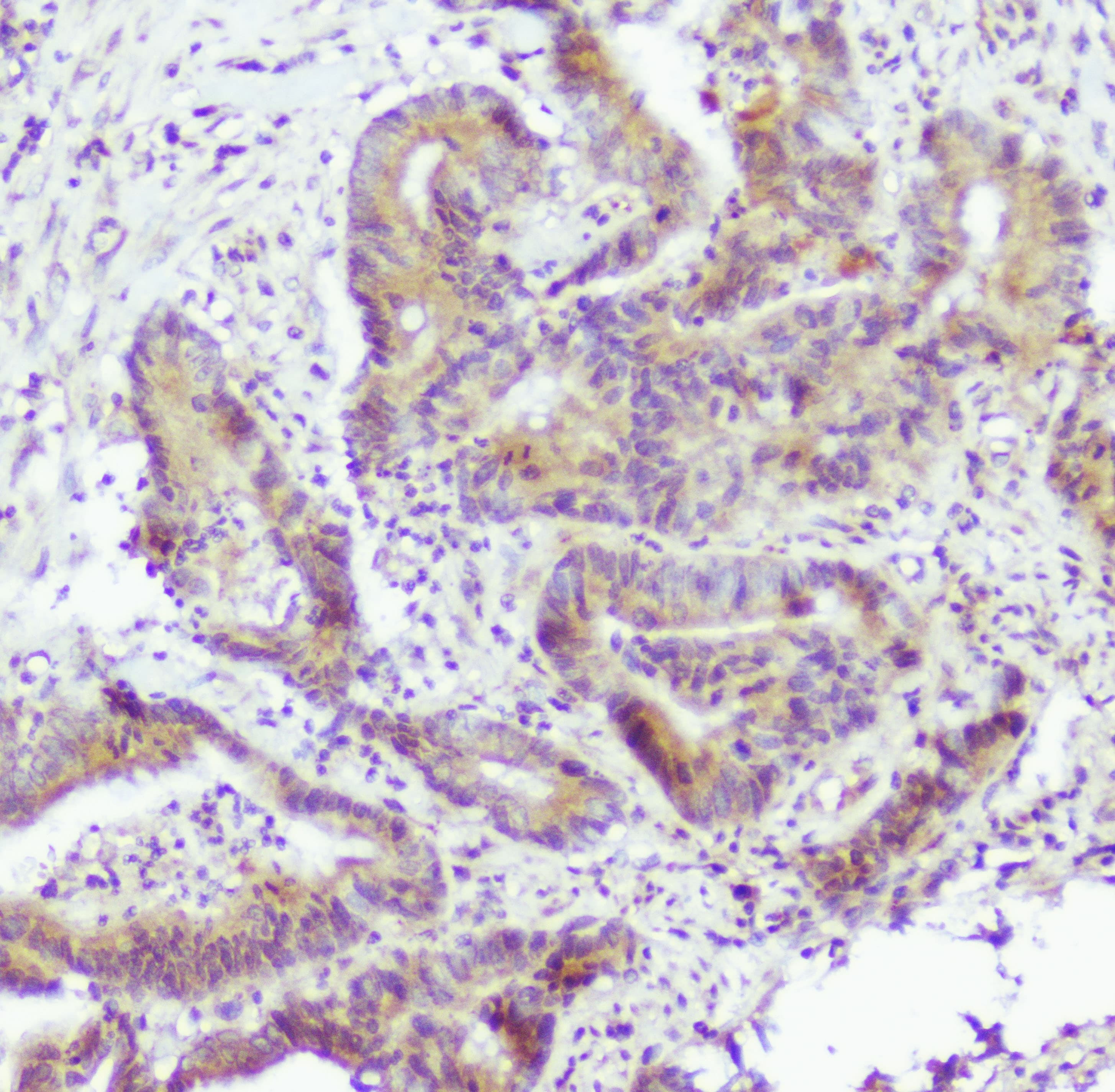 Polyclonal Rabbit anti-Human CASP2 / Caspase 2 Antibody (IHC, WB)