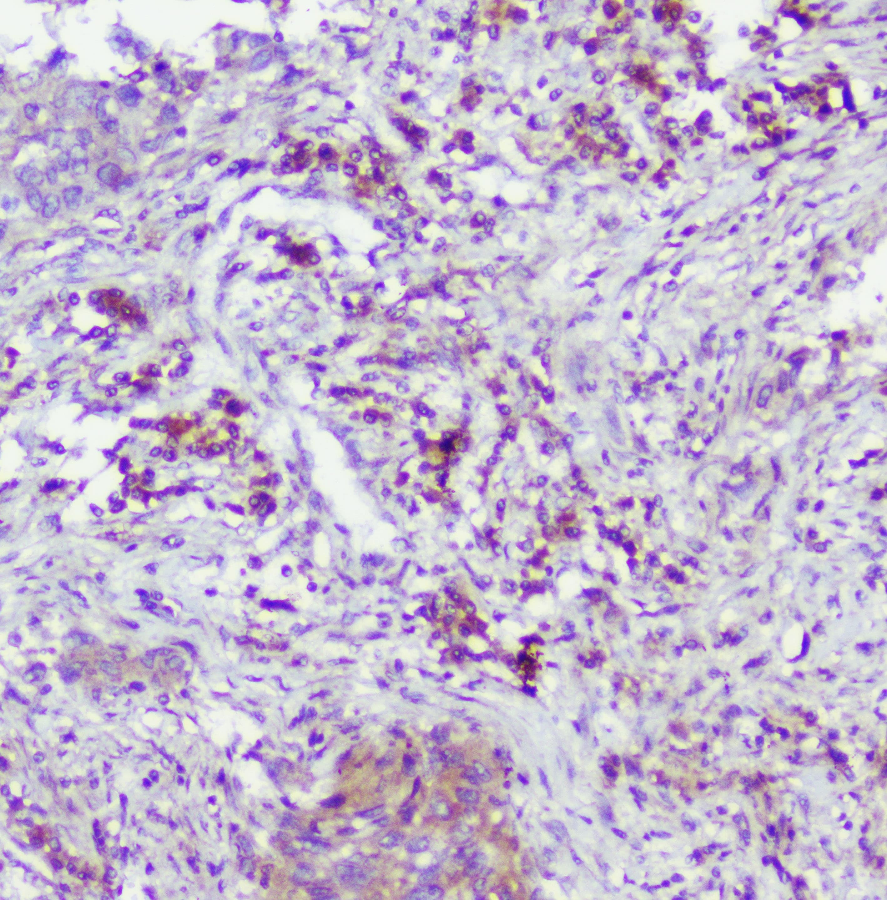 Polyclonal Rabbit anti-Human CASP2 / Caspase 2 Antibody (IHC, WB)