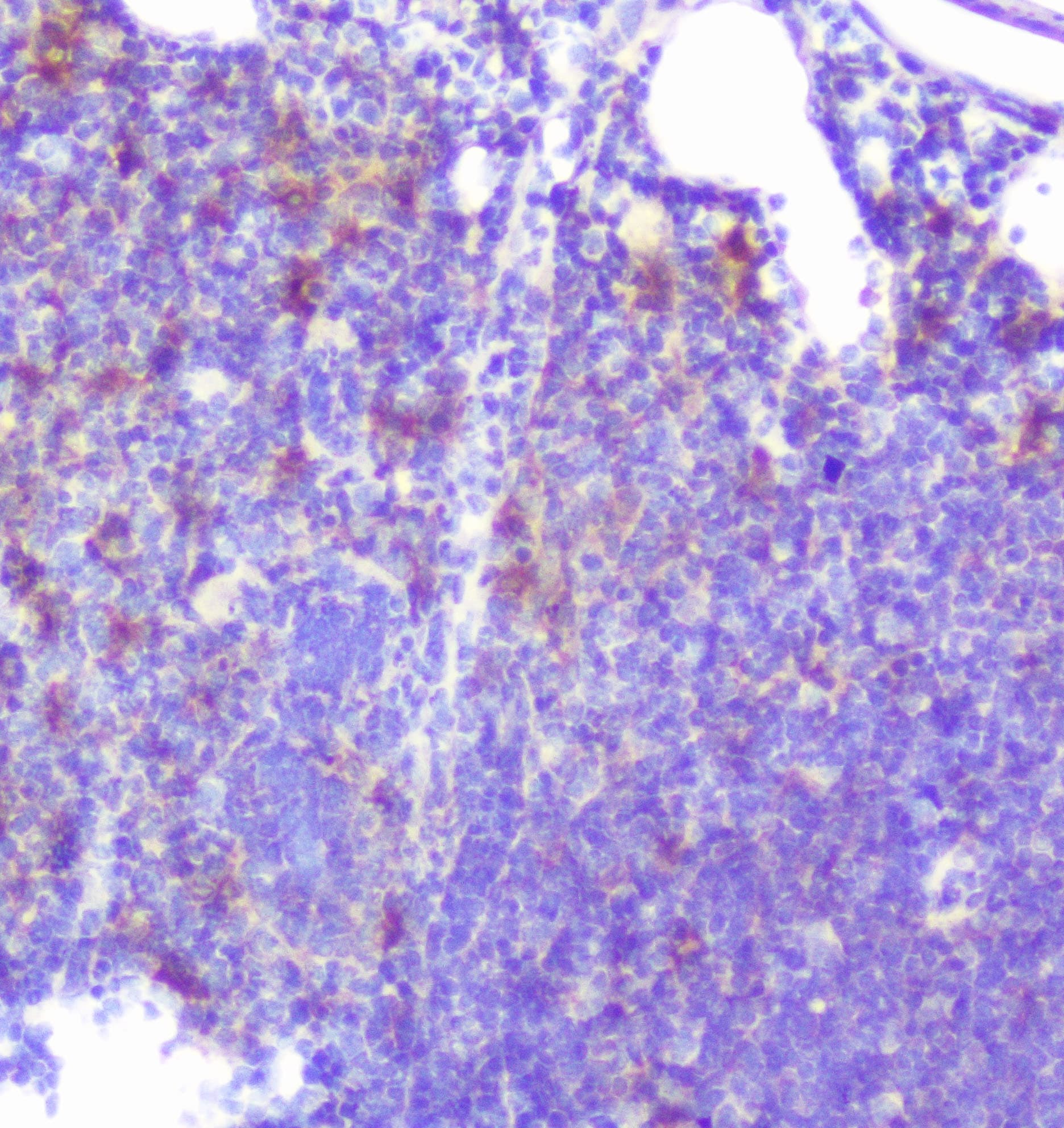 Polyclonal Rabbit anti-Human CASP2 / Caspase 2 Antibody (IHC, WB)