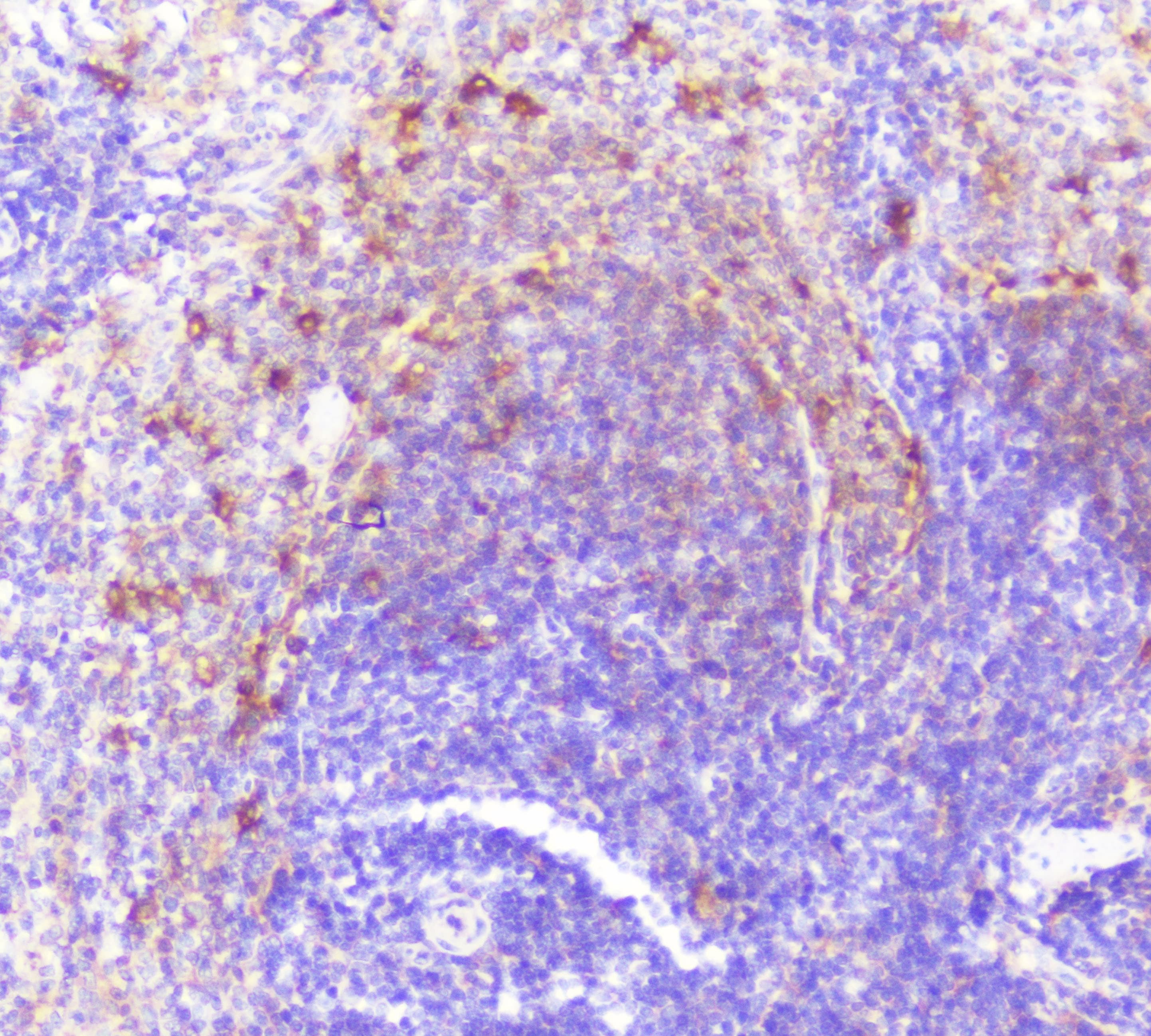 Polyclonal Rabbit anti-Human CASP2 / Caspase 2 Antibody (IHC, WB)