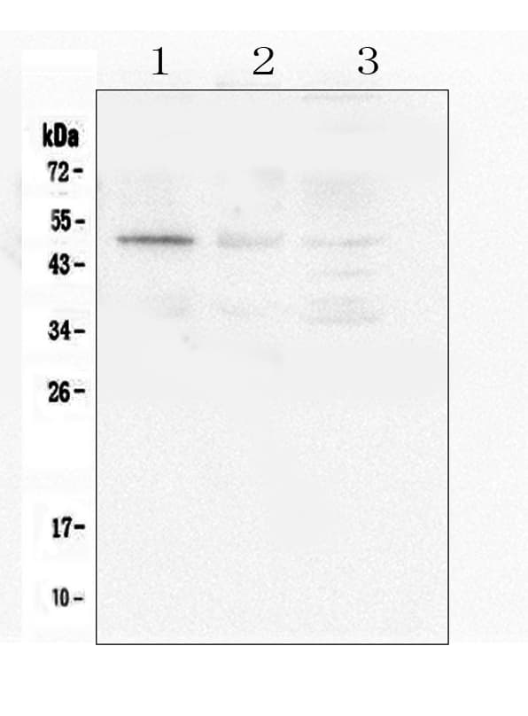 Polyclonal Rabbit anti-Human CASP2 / Caspase 2 Antibody (IHC, WB)