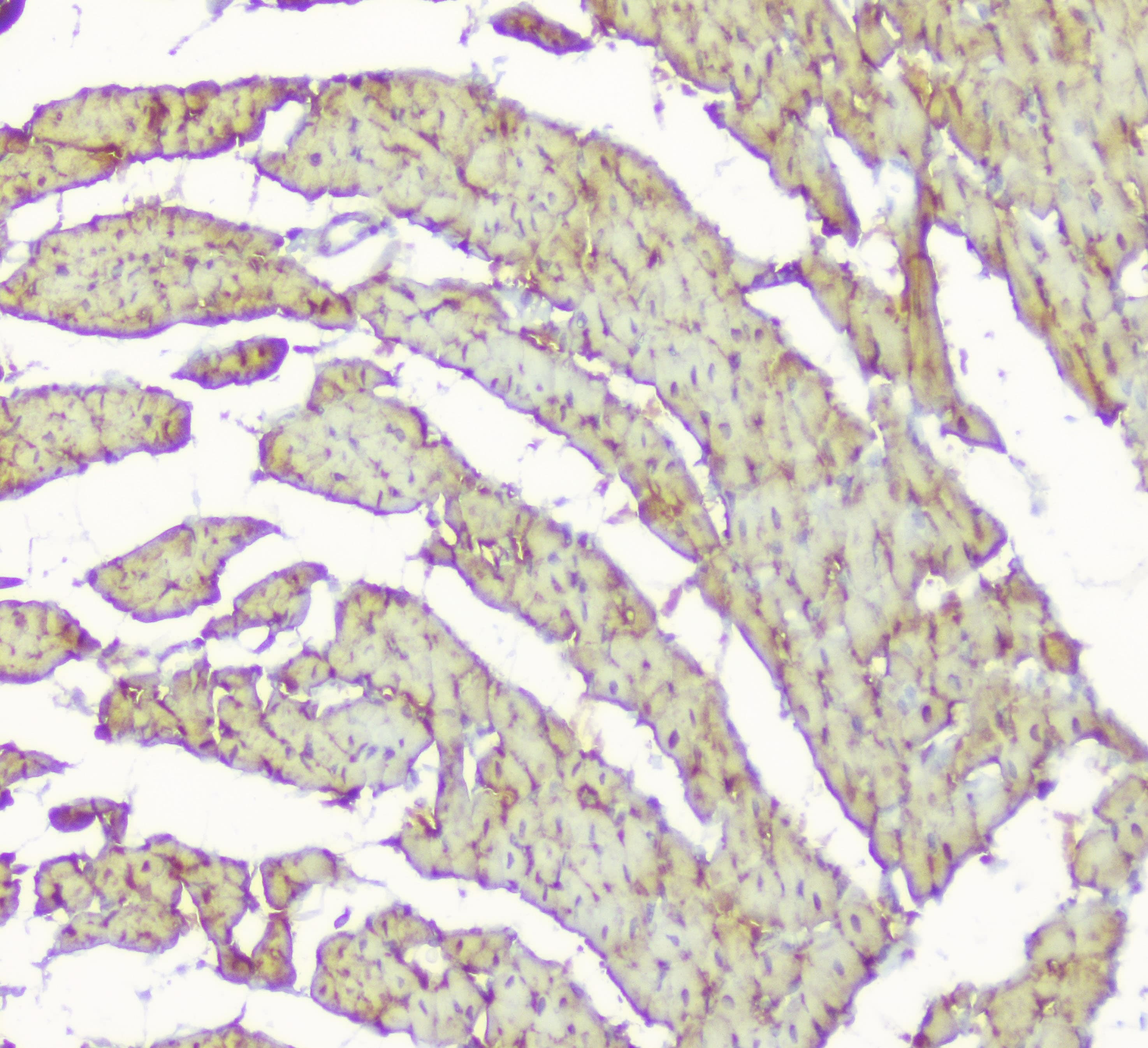 Polyclonal Rabbit anti-Human CKM / Creatine Kinase MM Antibody (IHC, WB)
