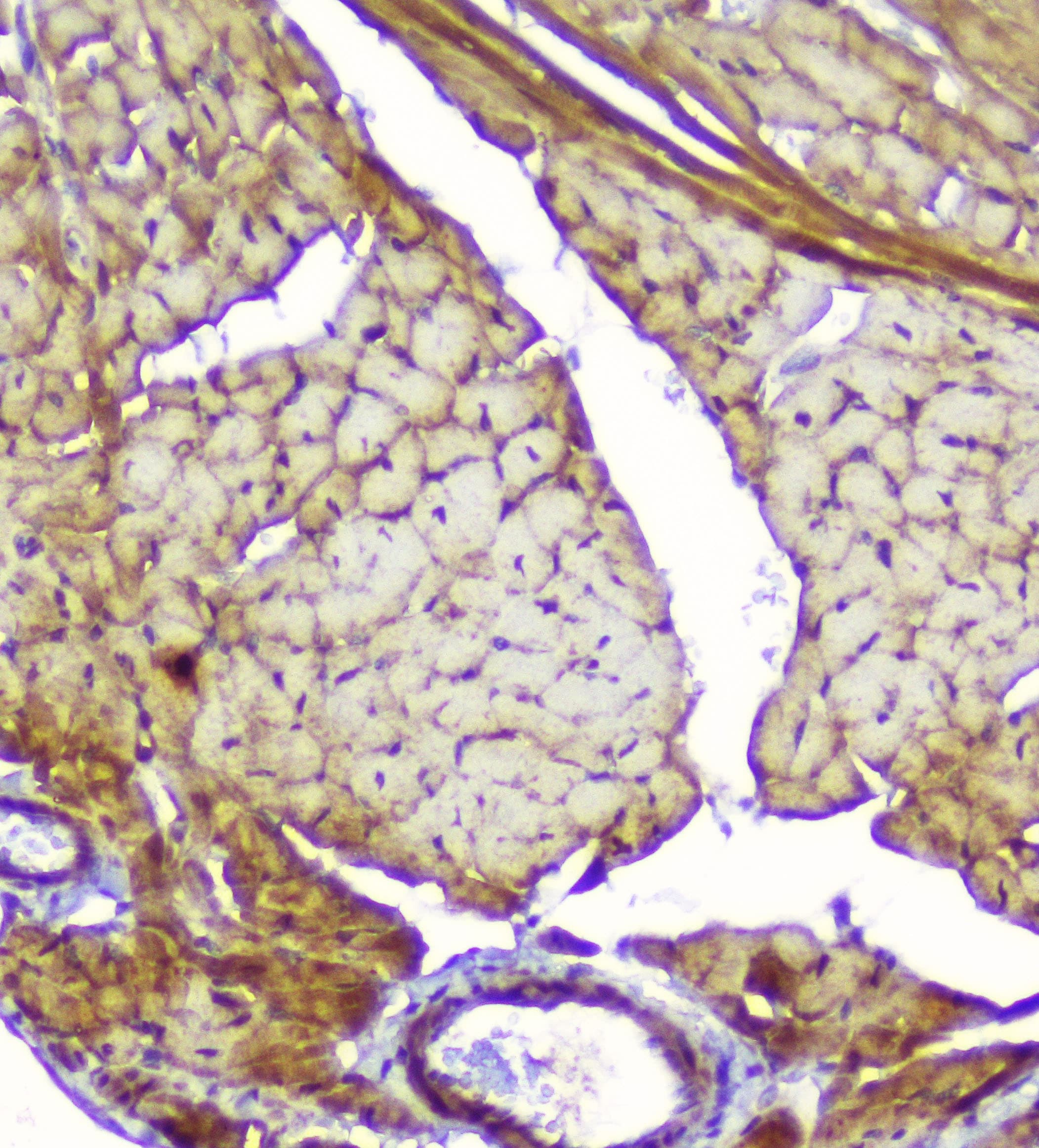 Polyclonal Rabbit anti-Human CKM / Creatine Kinase MM Antibody (IHC, WB)