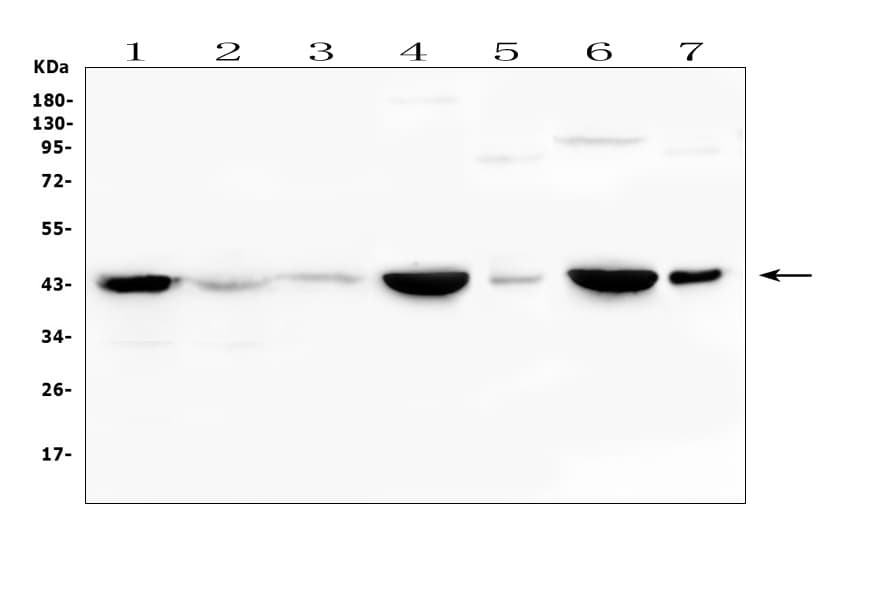 Polyclonal Rabbit anti-Human CKM / Creatine Kinase MM Antibody (IHC, WB)