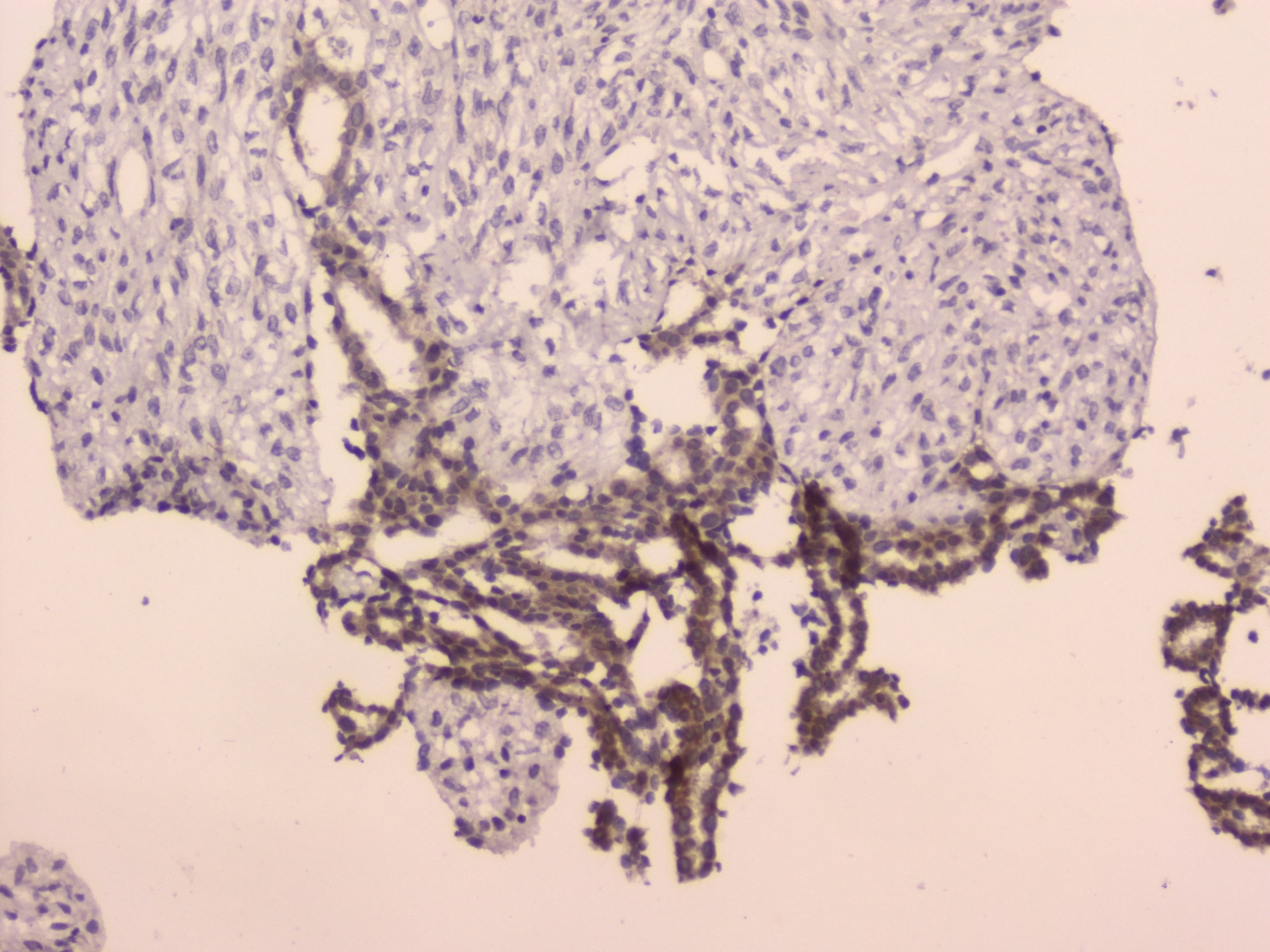 LRIG1 Antibody