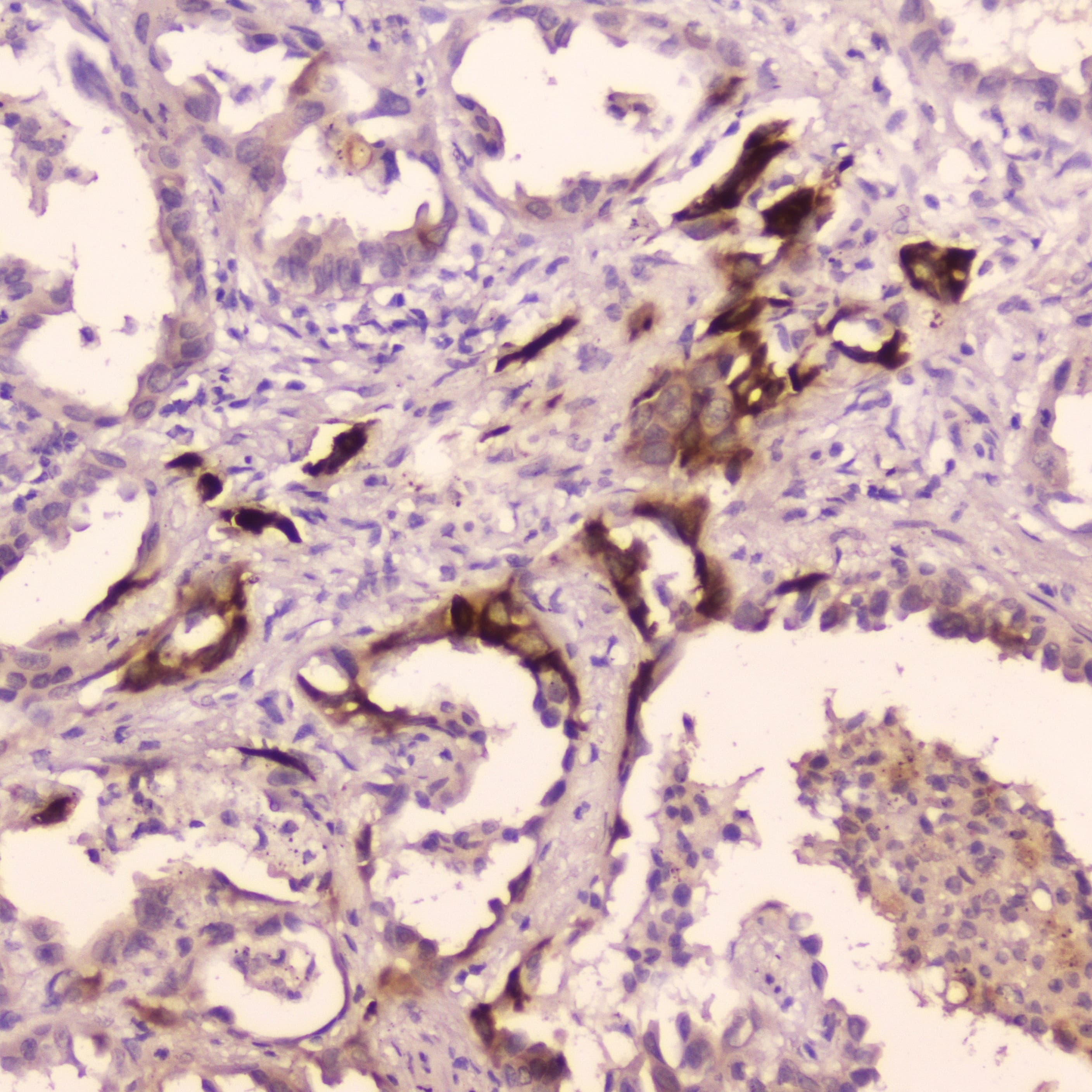 Polyclonal Rabbit anti-Human CTSE / Cathepsin E Antibody (IHC, WB)