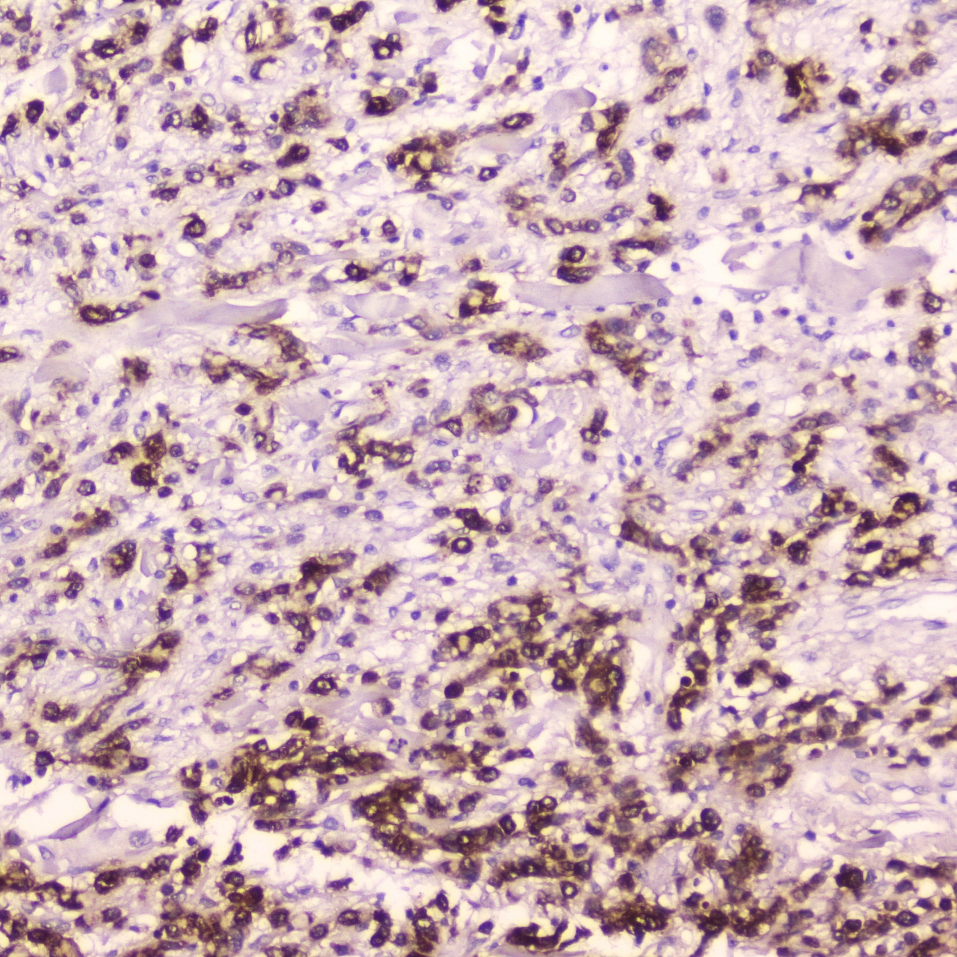 Polyclonal Rabbit anti-Human CTSE / Cathepsin E Antibody (IHC, WB)