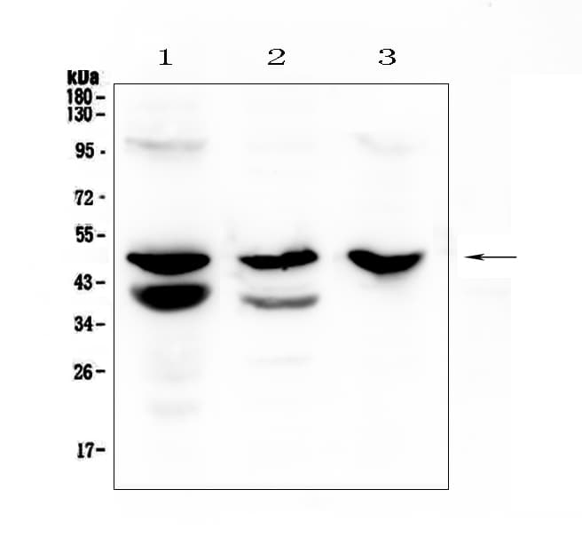 Polyclonal Rabbit anti-Human CTSE / Cathepsin E Antibody (IHC, WB)