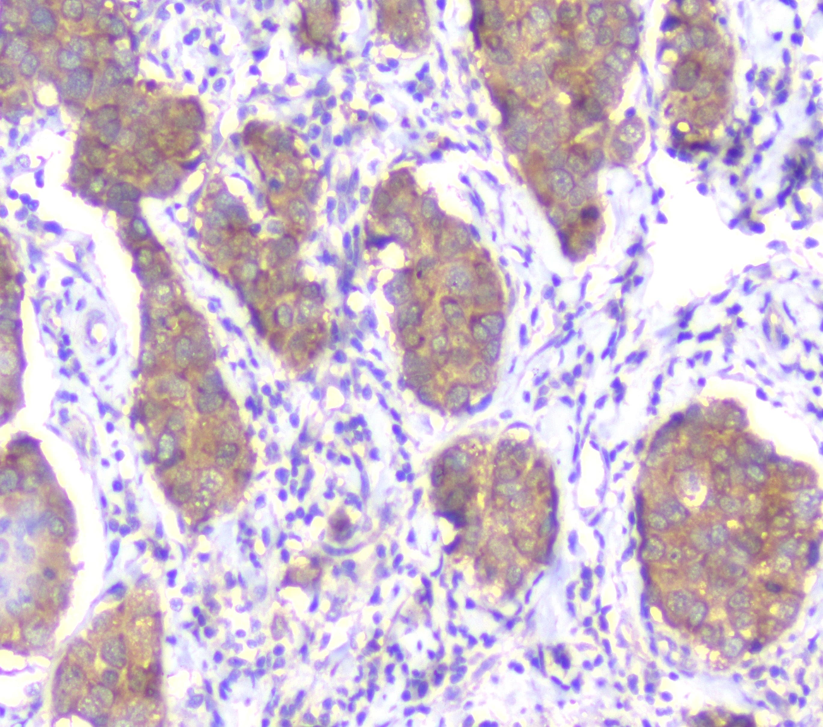 Monoclonal Mouse anti-Human SMN1 Antibody (IHC, WB)