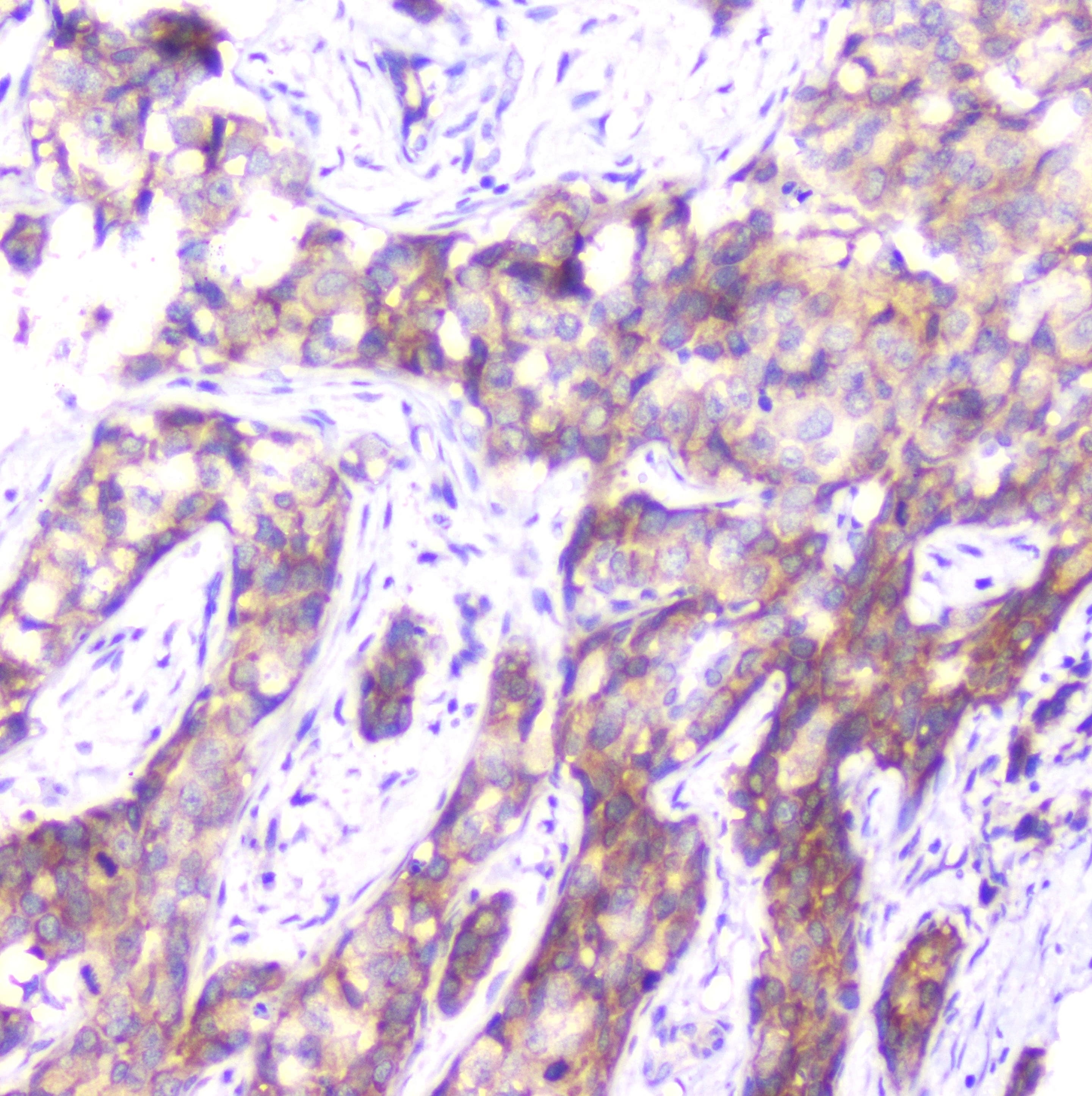 Monoclonal Mouse anti-Human SMN1 Antibody (IHC, WB)