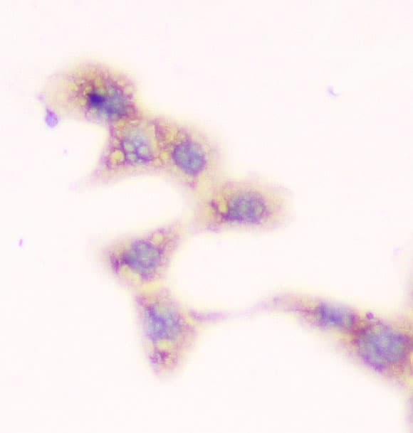 Monoclonal Mouse anti-Human SMN1 Antibody (IHC, WB)