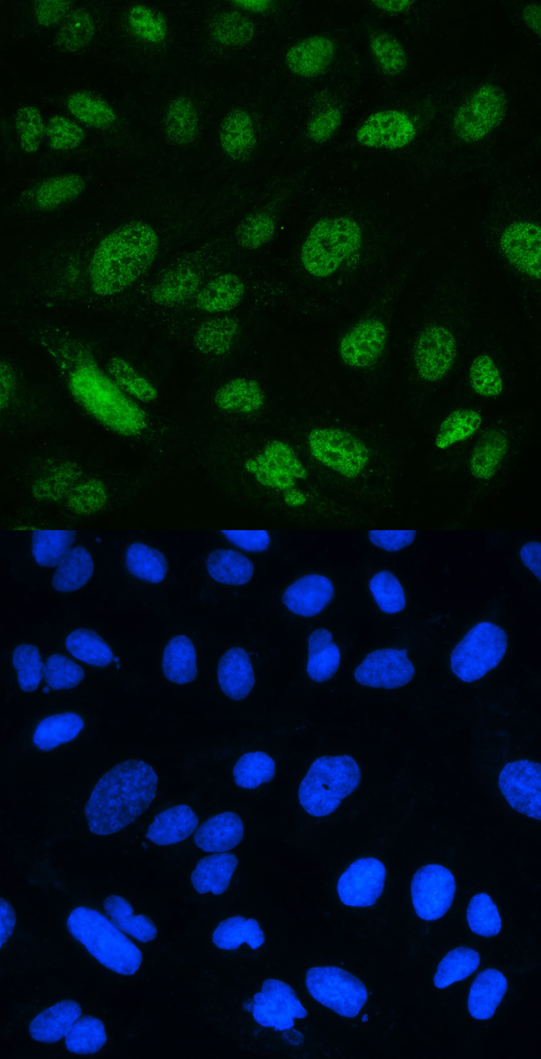 Polyclonal Rabbit anti-Human MSH2 Antibody (aa337-583, IHC, WB)