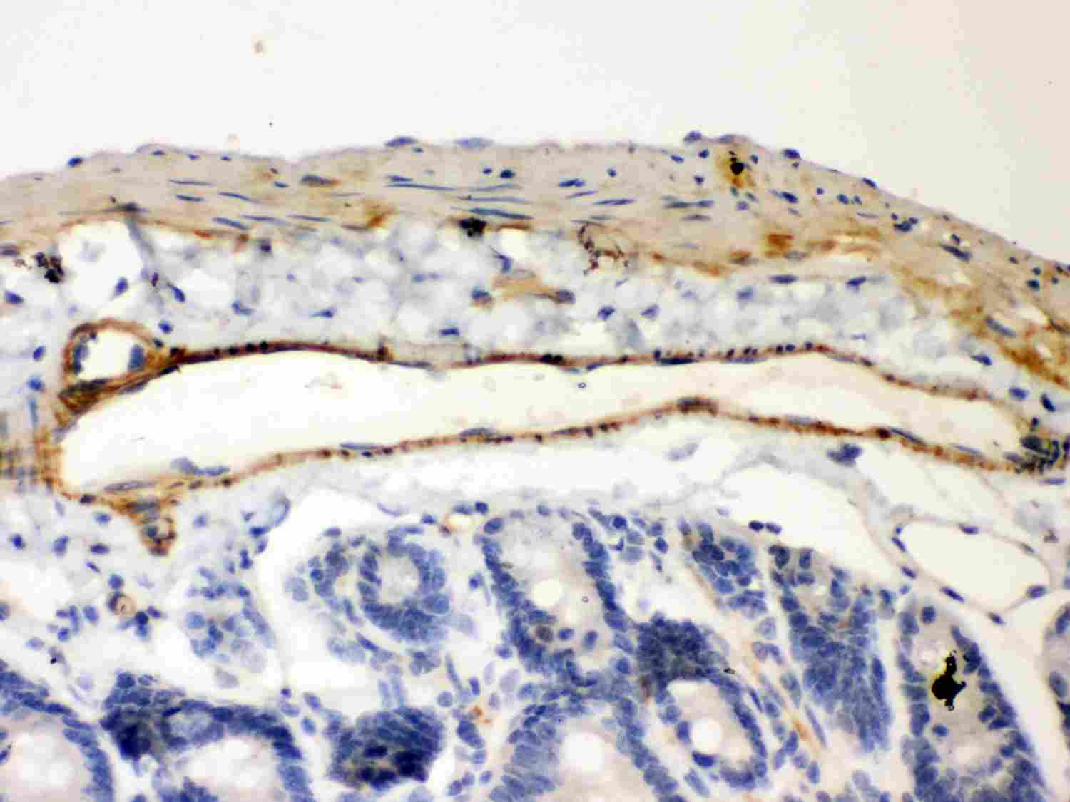Polyclonal Rabbit anti-Human NFKBIB / IKB Beta / IKBB Antibody (aa56-237, IHC, WB)