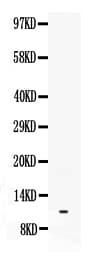 Polyclonal Rabbit anti-Human Neuropeptide Y / NPY Antibody (aa29-64, IHC, WB)