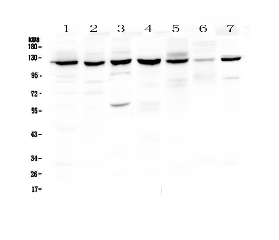 Polyclonal Rabbit anti-Human PARP1 Antibody (aa670-858, IHC, WB)