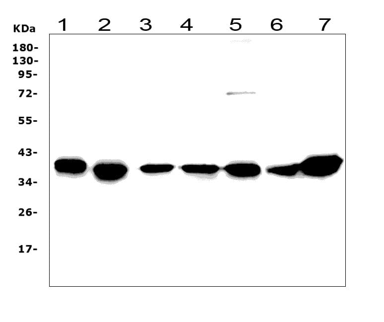 Polyclonal Rabbit anti-Human RAD51 / RECA Antibody (aa1-258, IHC, WB)